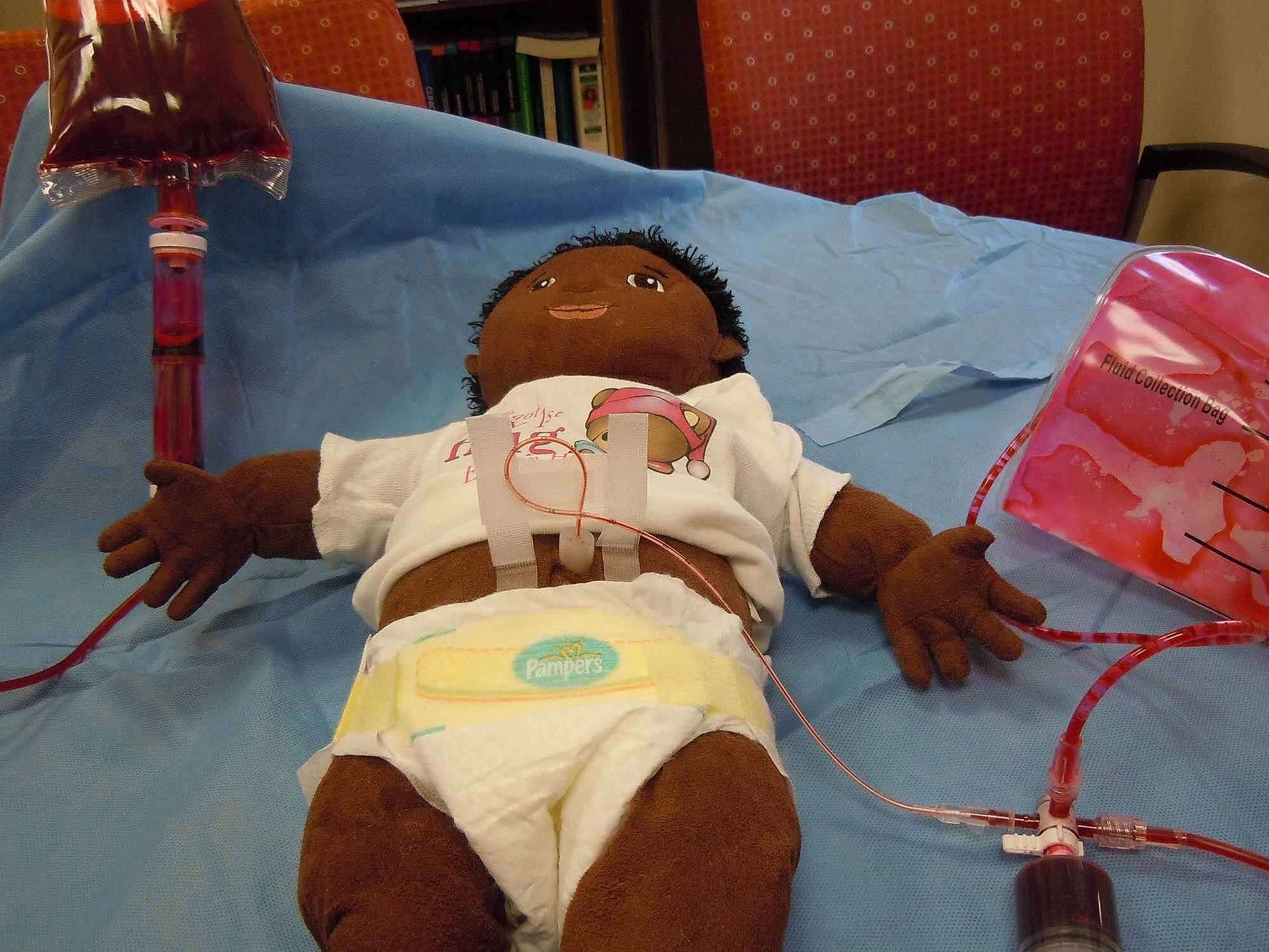 Cureus Exchange Transfusion Simulation Models A Technical Report