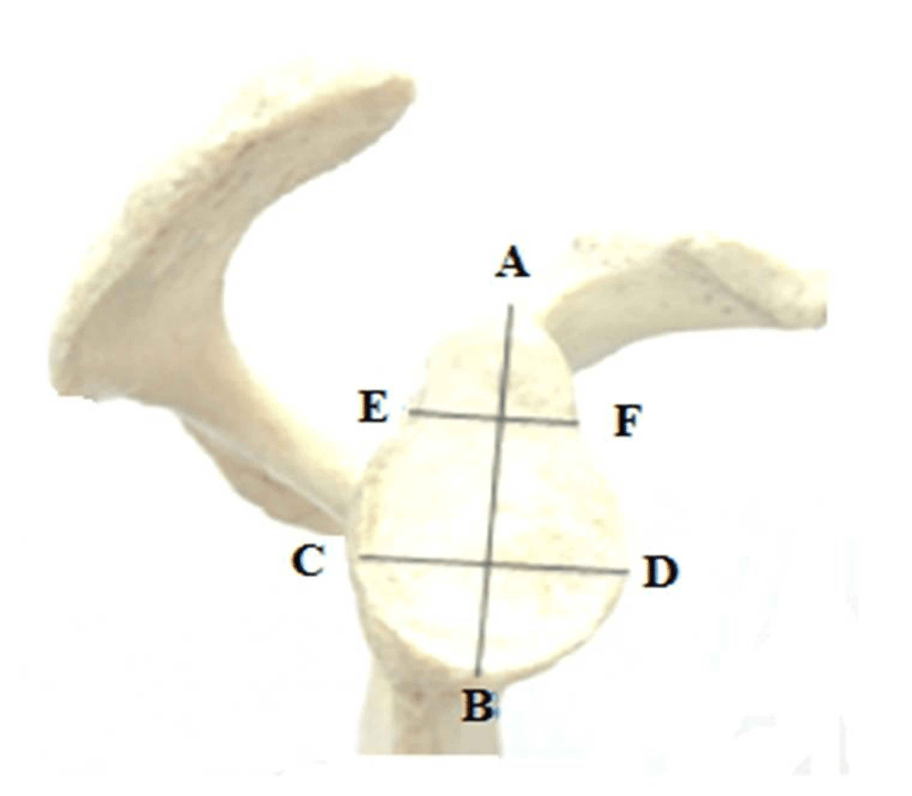 Cureus | The Glenoid Fossa’s Morphometric Investigation and Its ...