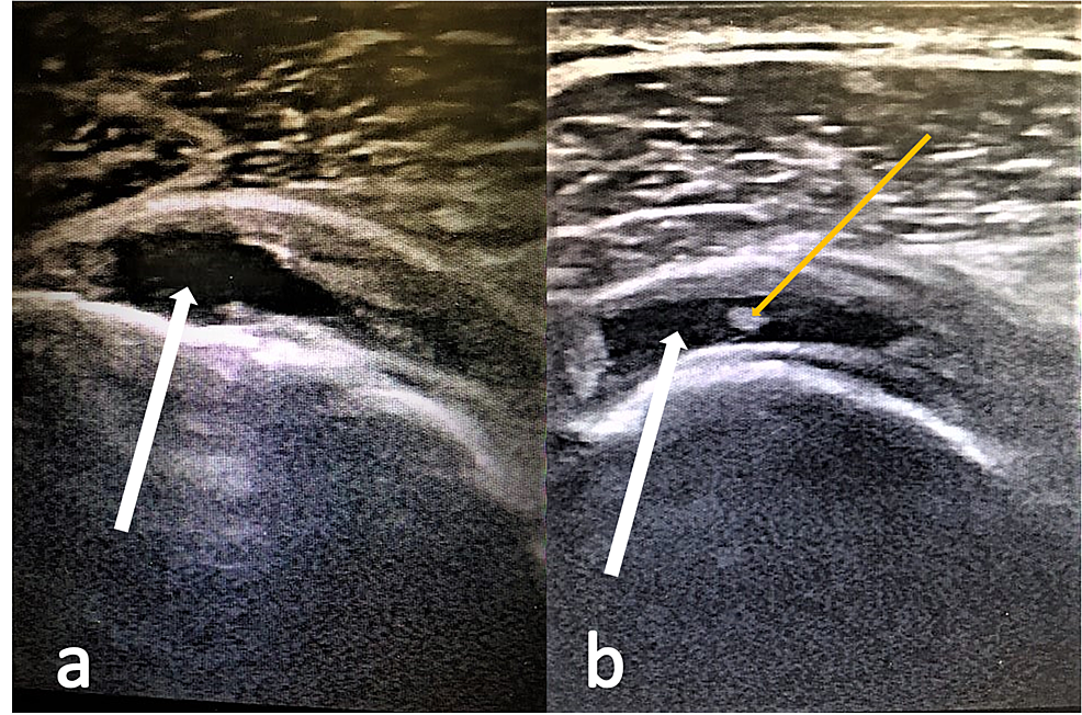 Cureus The Sensitivity of Resonance Imaging and