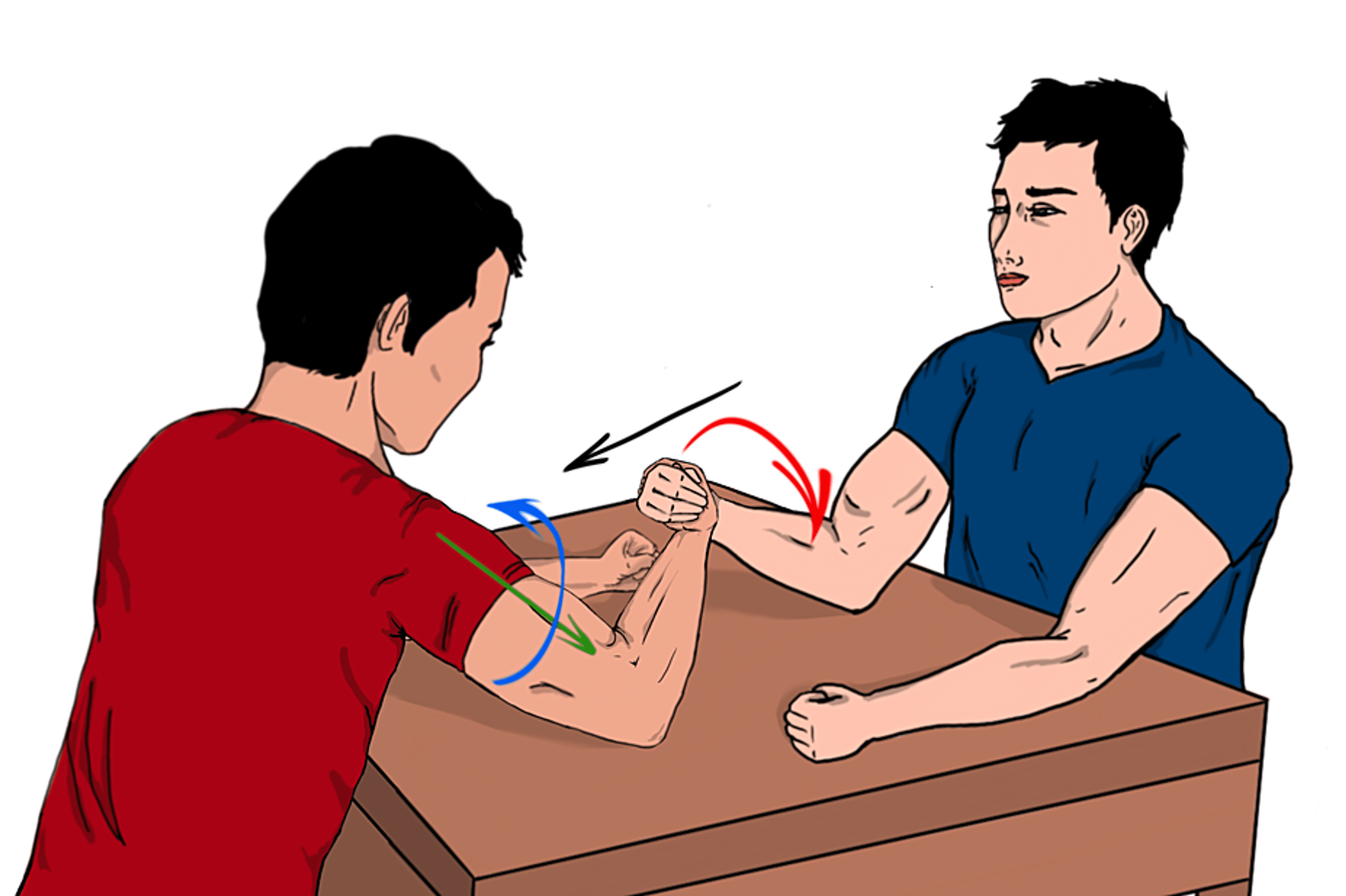 Cureus Conservative Management of a Distal Humerus Spiral Fracture Sustained During Arm