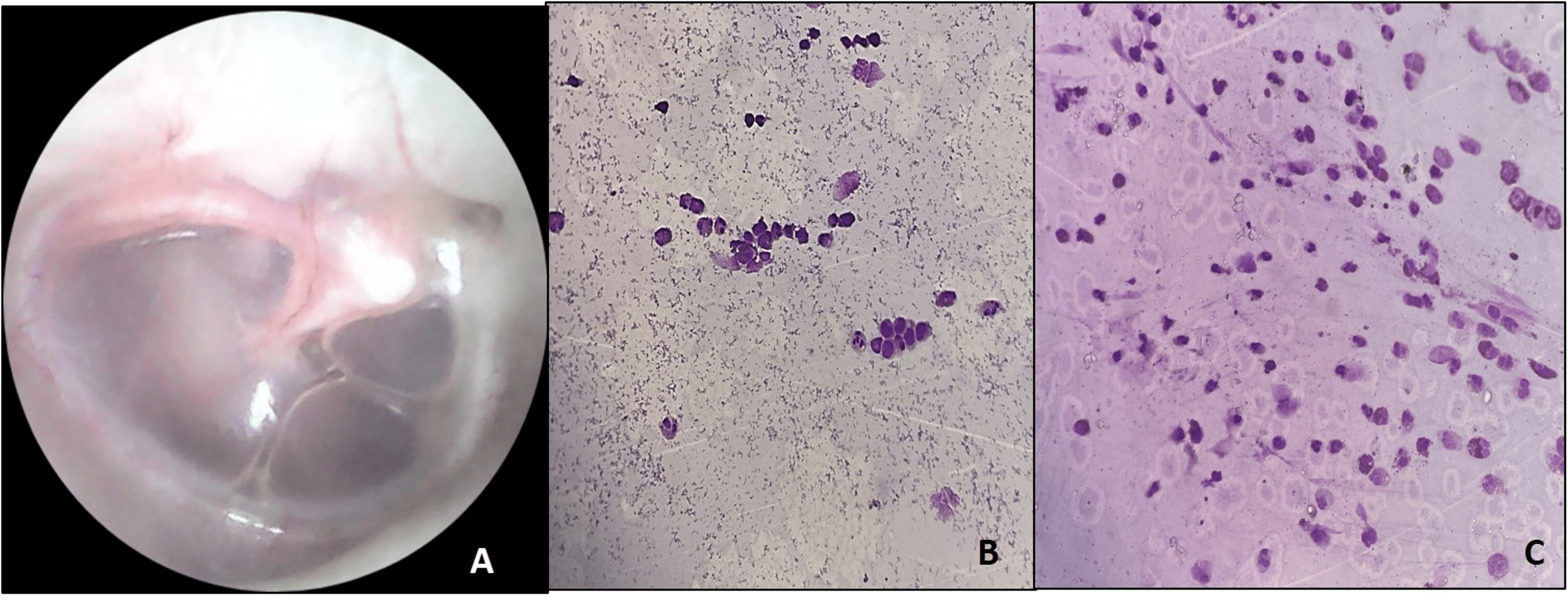 Cureus | Evaluation of the Association Between Allergic Rhinitis and ...