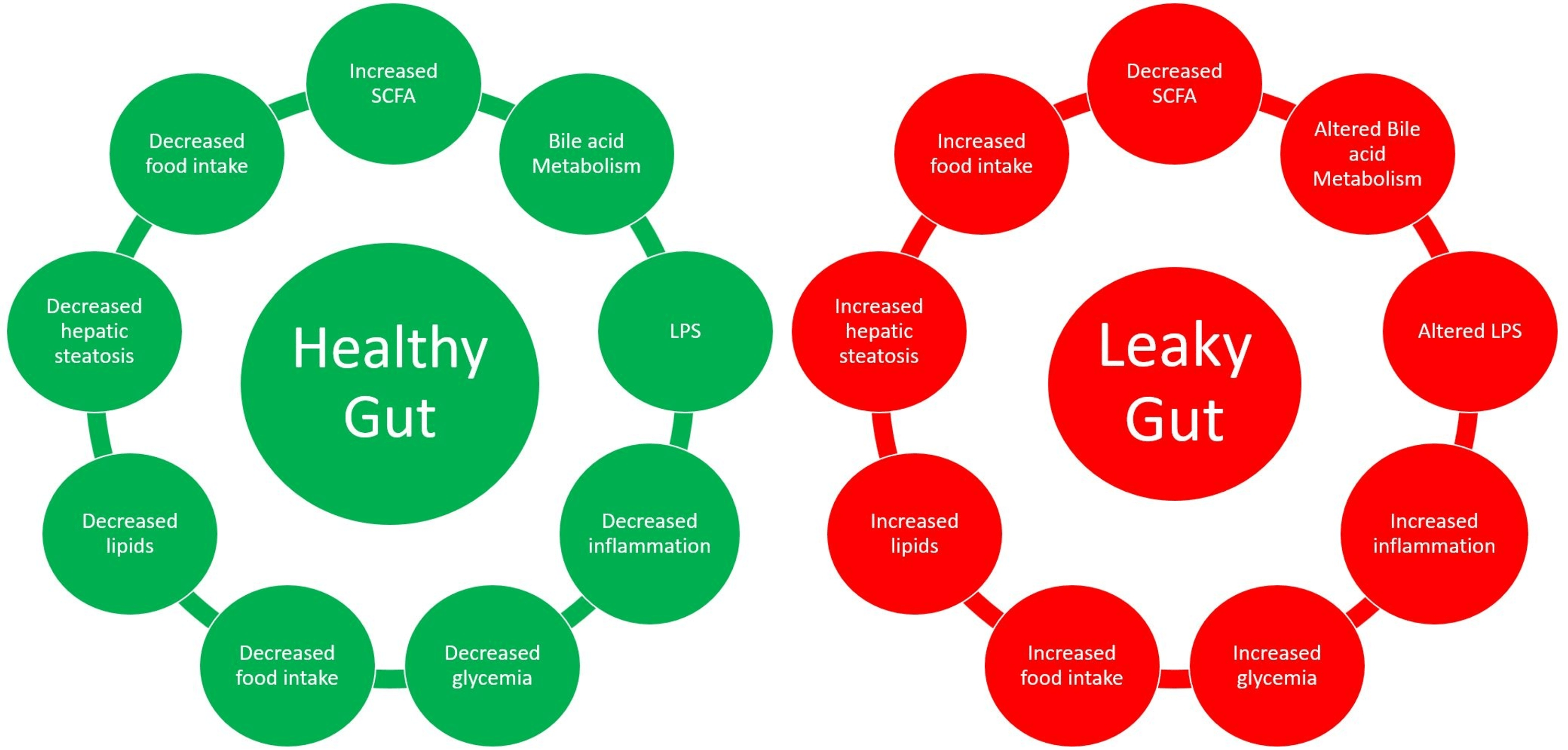 Cureus Understanding the Role of the Gut Microbiome in Diabetes and