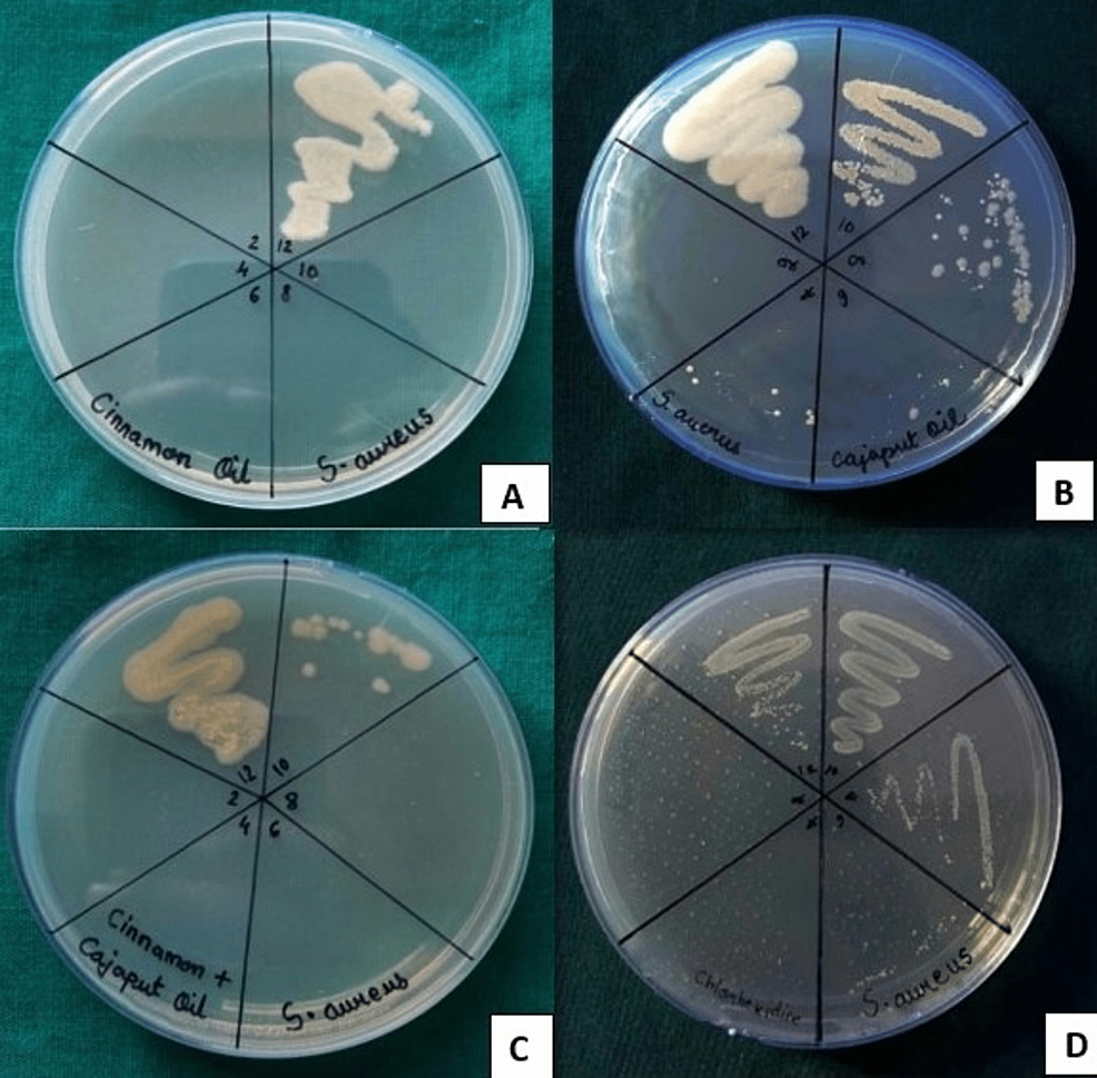 Cureus Antimicrobial Efficacy of Essential Oils and Their