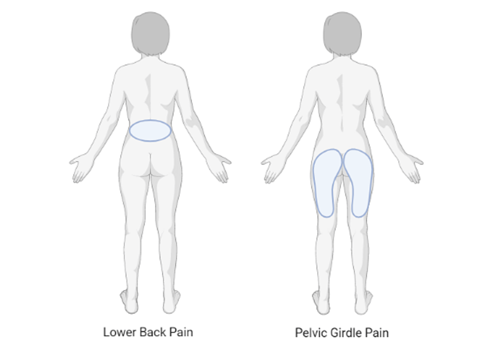 Back & Pelvic Girdle Pain in Pregnancy & Postpartum: Find relief using the  Pelvic Girdle Musculoskeletal Method