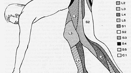 Cureus | Abdominal Wall Hematoma Secondary to Dissection of the Deep ...