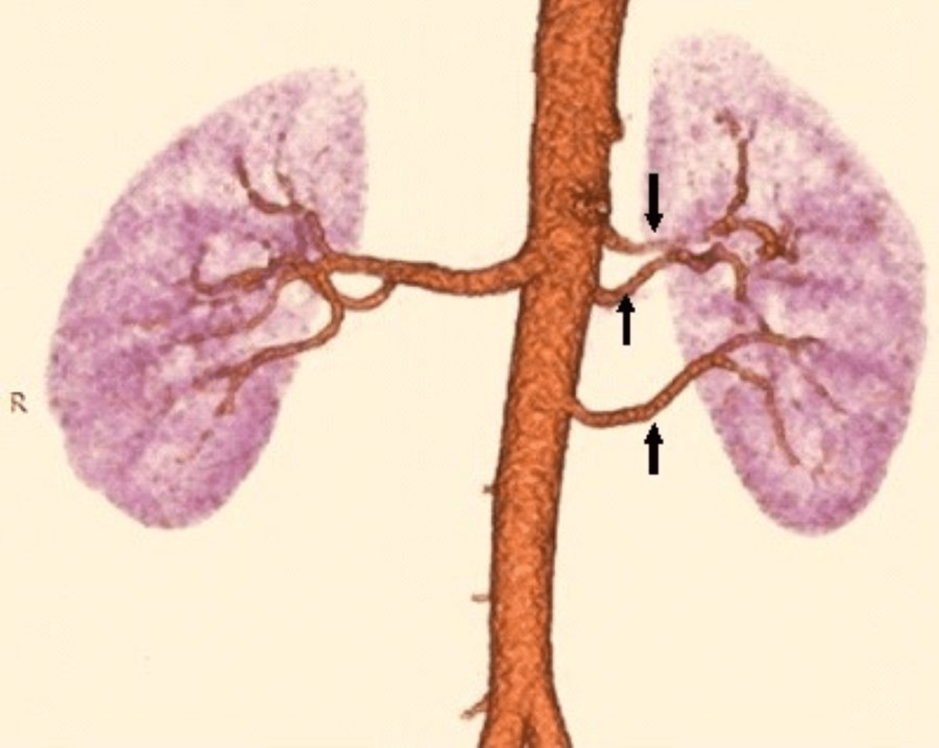 Cureus | Vascular Variations and Incidental Pathologies in Potential ...