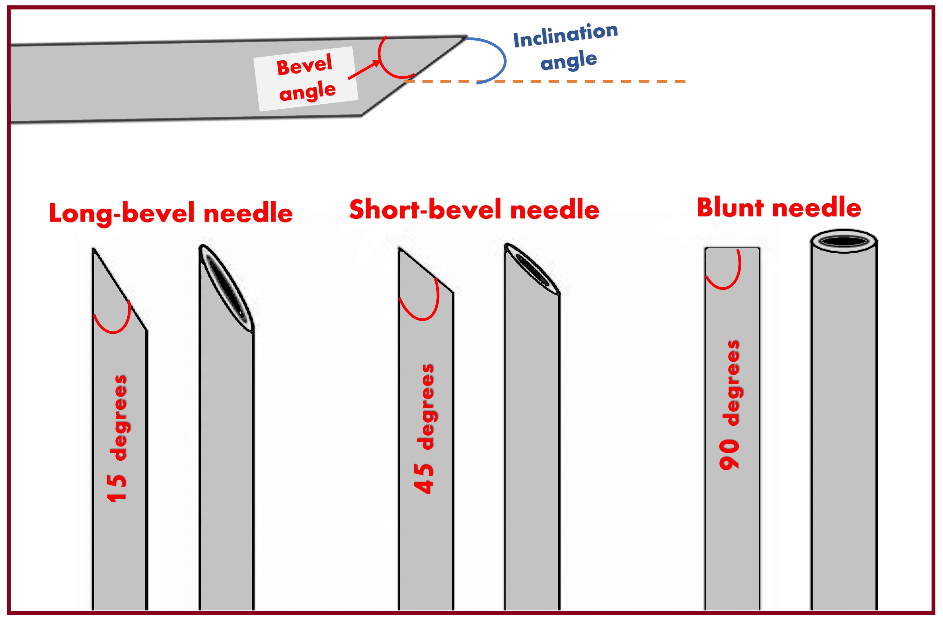 Cureus “Knowing It Before Blocking It,” the ABCD of the Peripheral