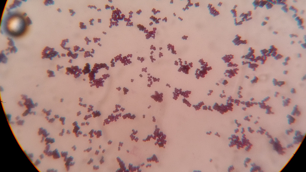identifying micrococcus luteus essay I need help identifying an unknown it's probably micrococcus luteusthe then you can start to narrow down what tests will give the most info on identifying. identifying micrococcus luteus essay I need help identifying an unknown it's probably micrococcus luteusthe then you can start to narrow down what tests will give the most info on identifying.
