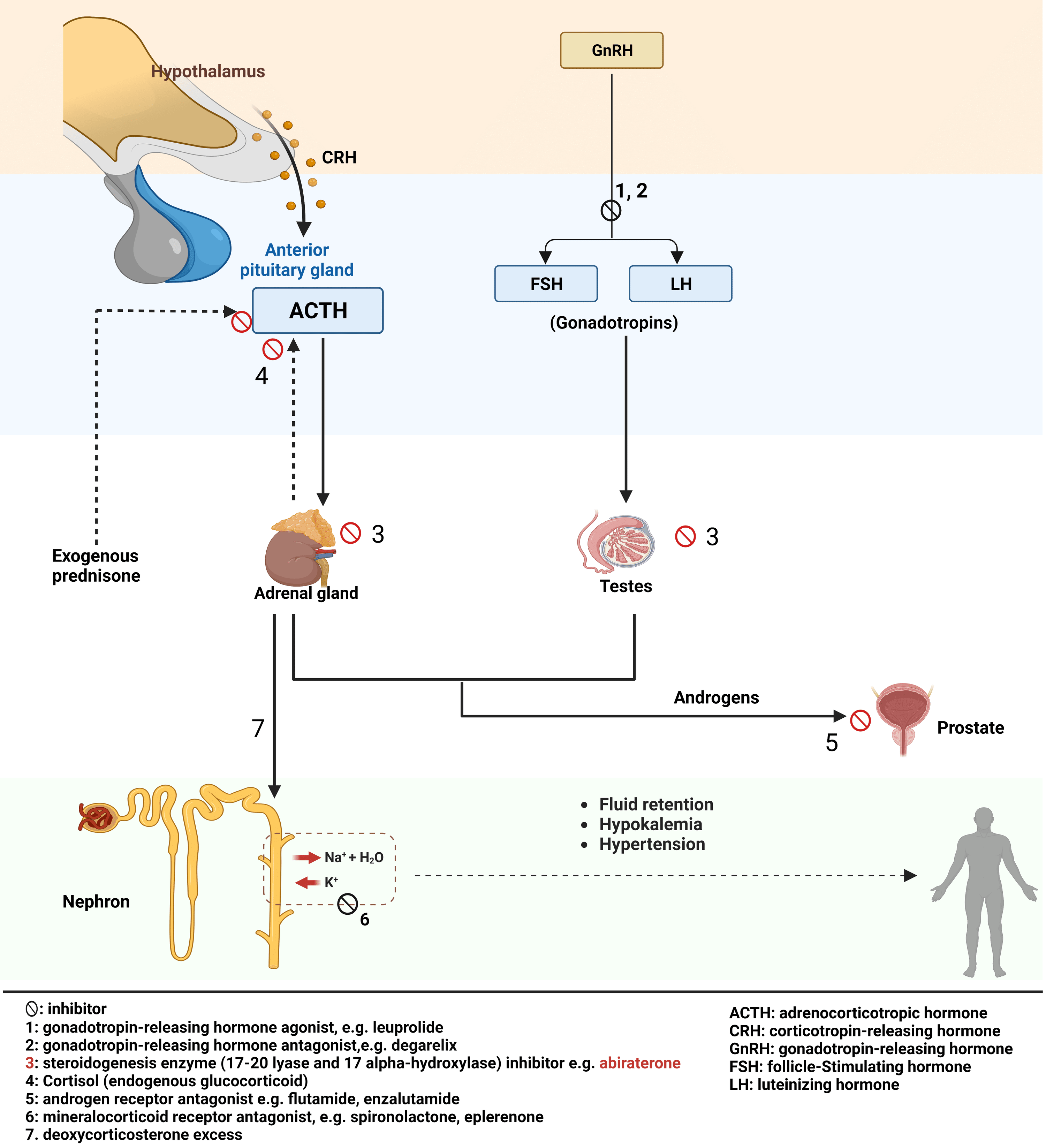 Cureus | Abiraterone-Induced Hypokalemia: A Case Report