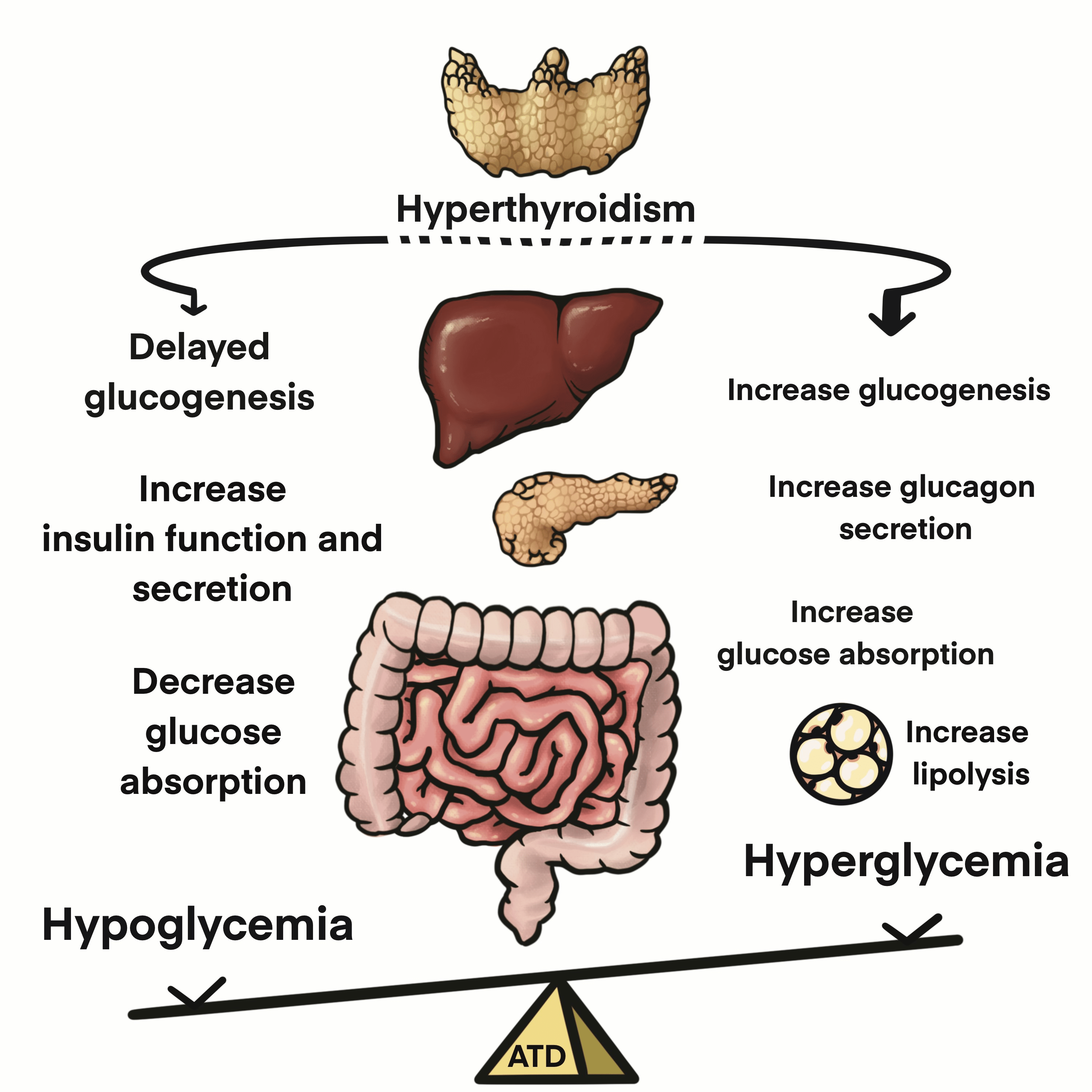 Cureus Safety of Antithyroid Drugs in Avoiding Hyperglycemia or