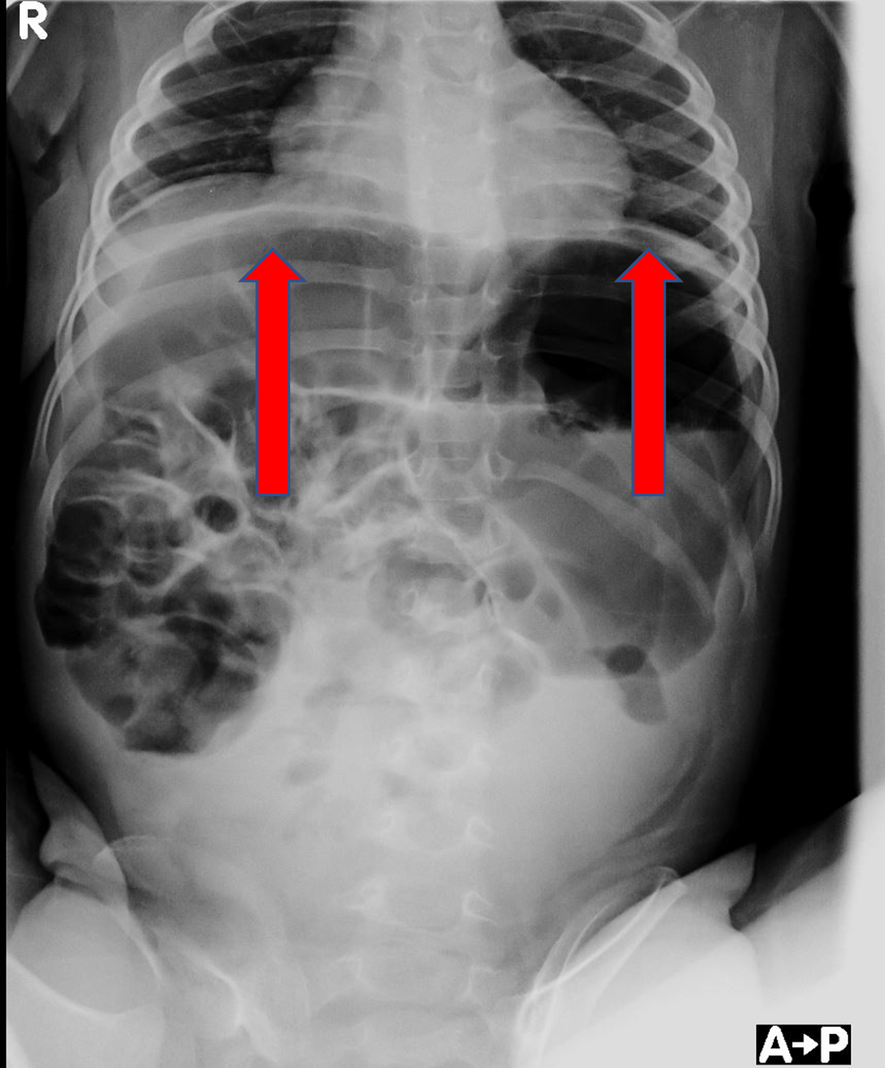 Unusual Inconsolable Crying: An Insight, Case Report, And Review Of The 