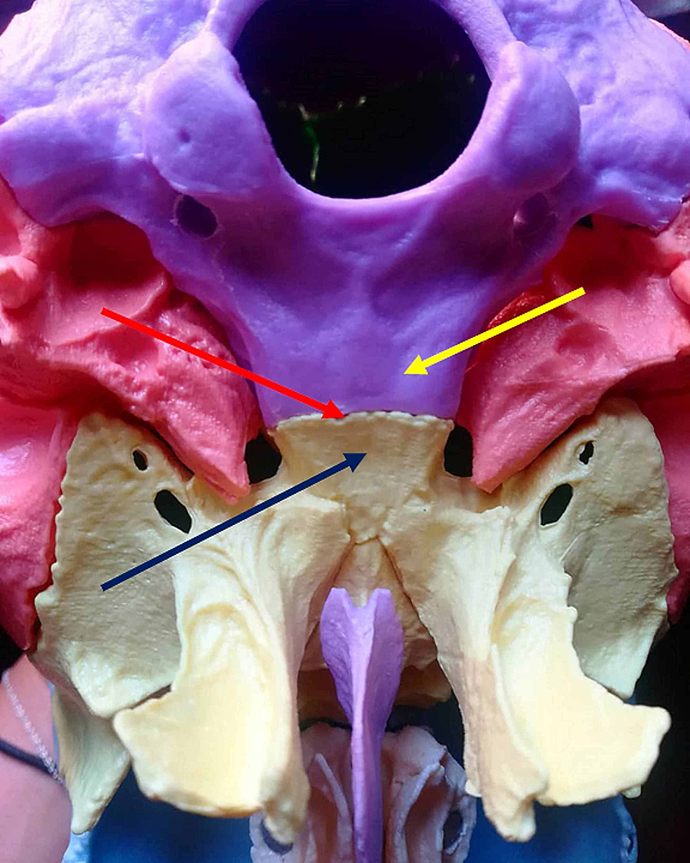 The-figure-illustrates-the-synchondrosis-articulation-between-the-occipital-bone-and-the-sphenoid-bone,-with-a-view-of-the-base-of-the-skull.-The-red-arrow-indicates-the-synchondrosis-articulation;-the-yellow-arrow-indicates-the-basiocciput;-the-blue-arrow-indicates-the-body-of-the-sphenoid.