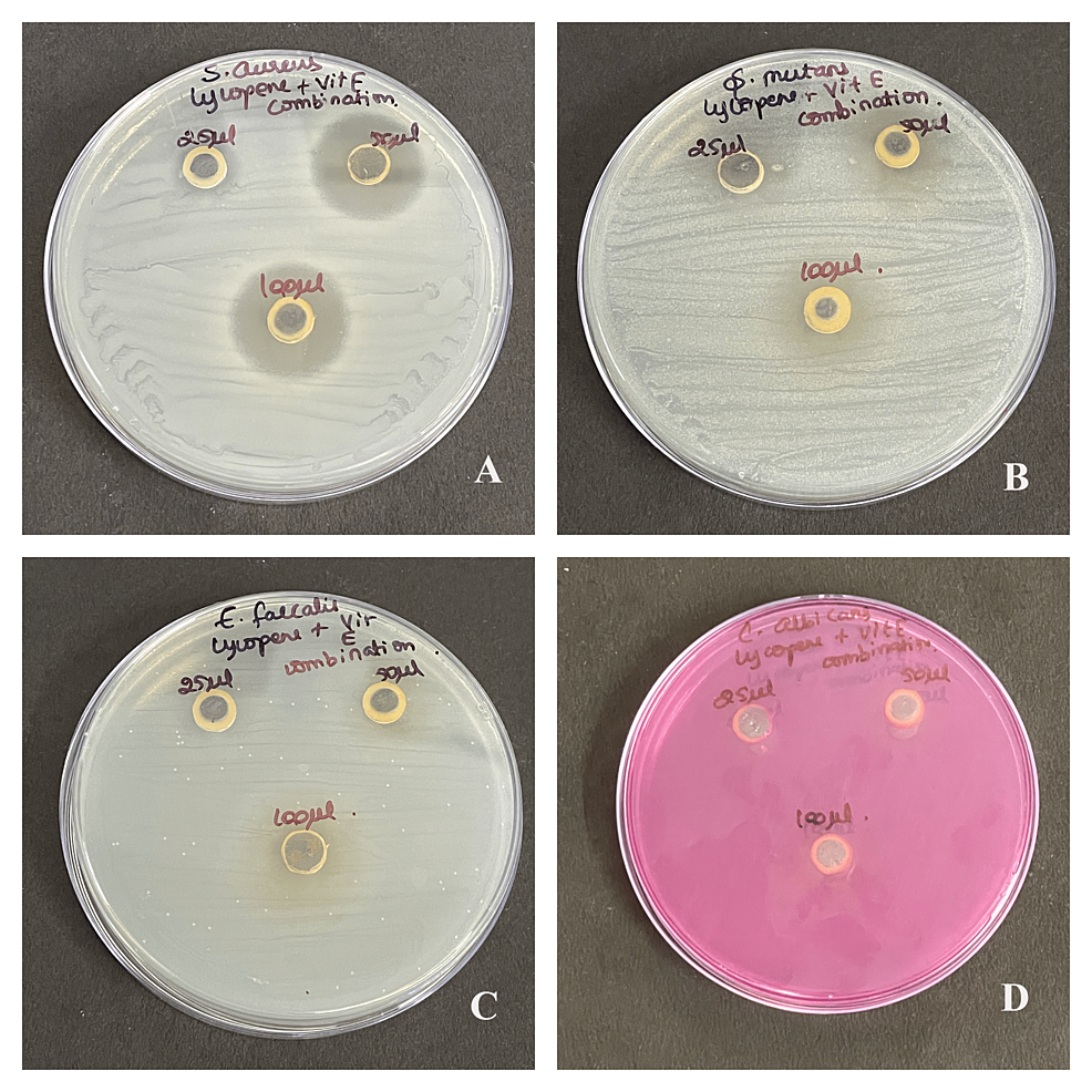 Assessment of Antimicrobial Activity of Lycopene, Vitamin E, and