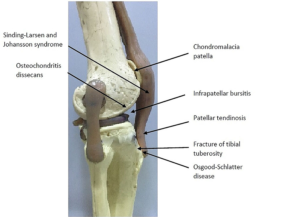 What Can Cause Swelling Above Knee What is its Treatment?