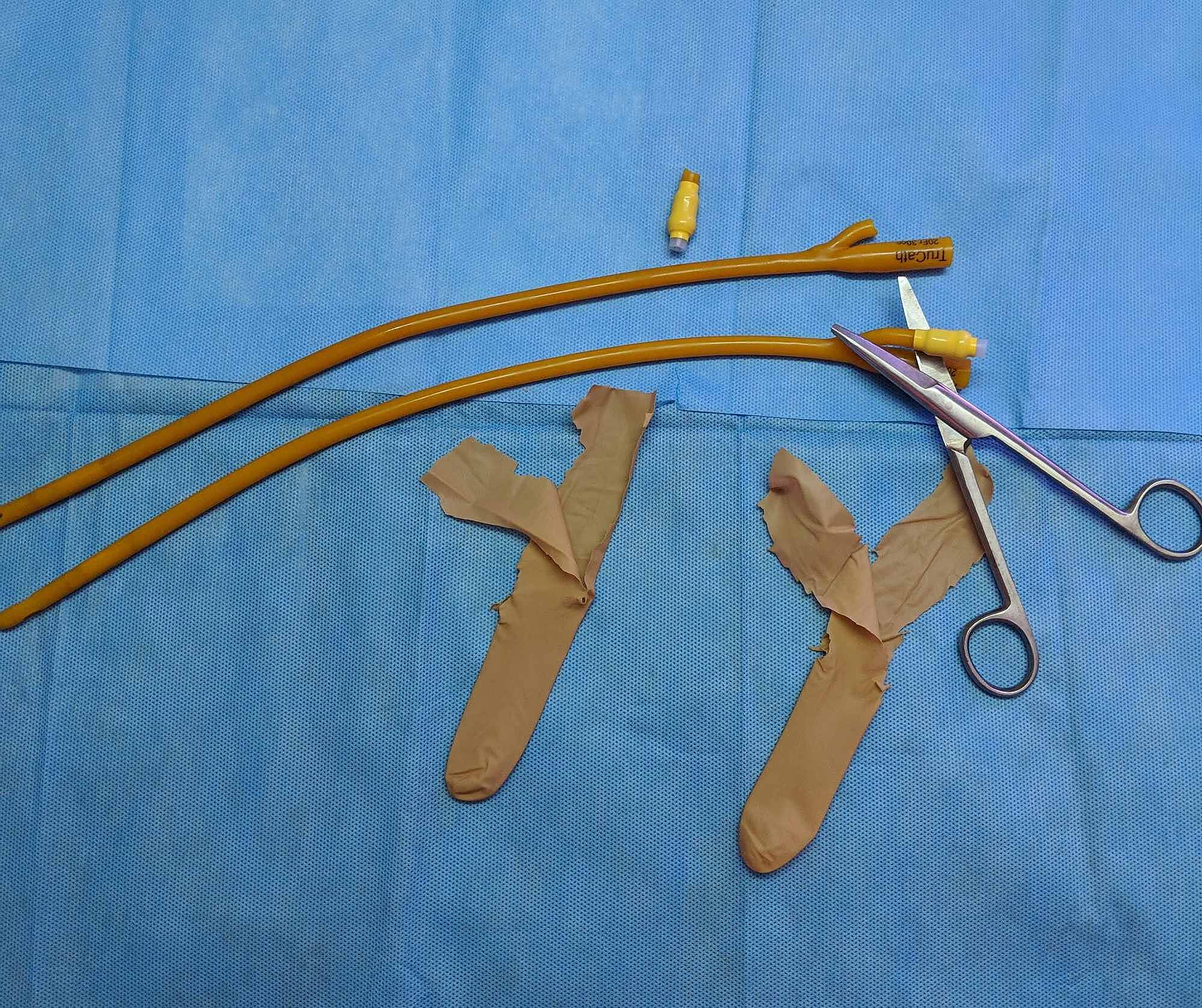 Cureus How to Make a DoItYourself, Disposable Bite Guard Using