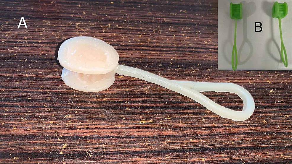 Cureus How to Make a DoItYourself, Disposable Bite Guard Using