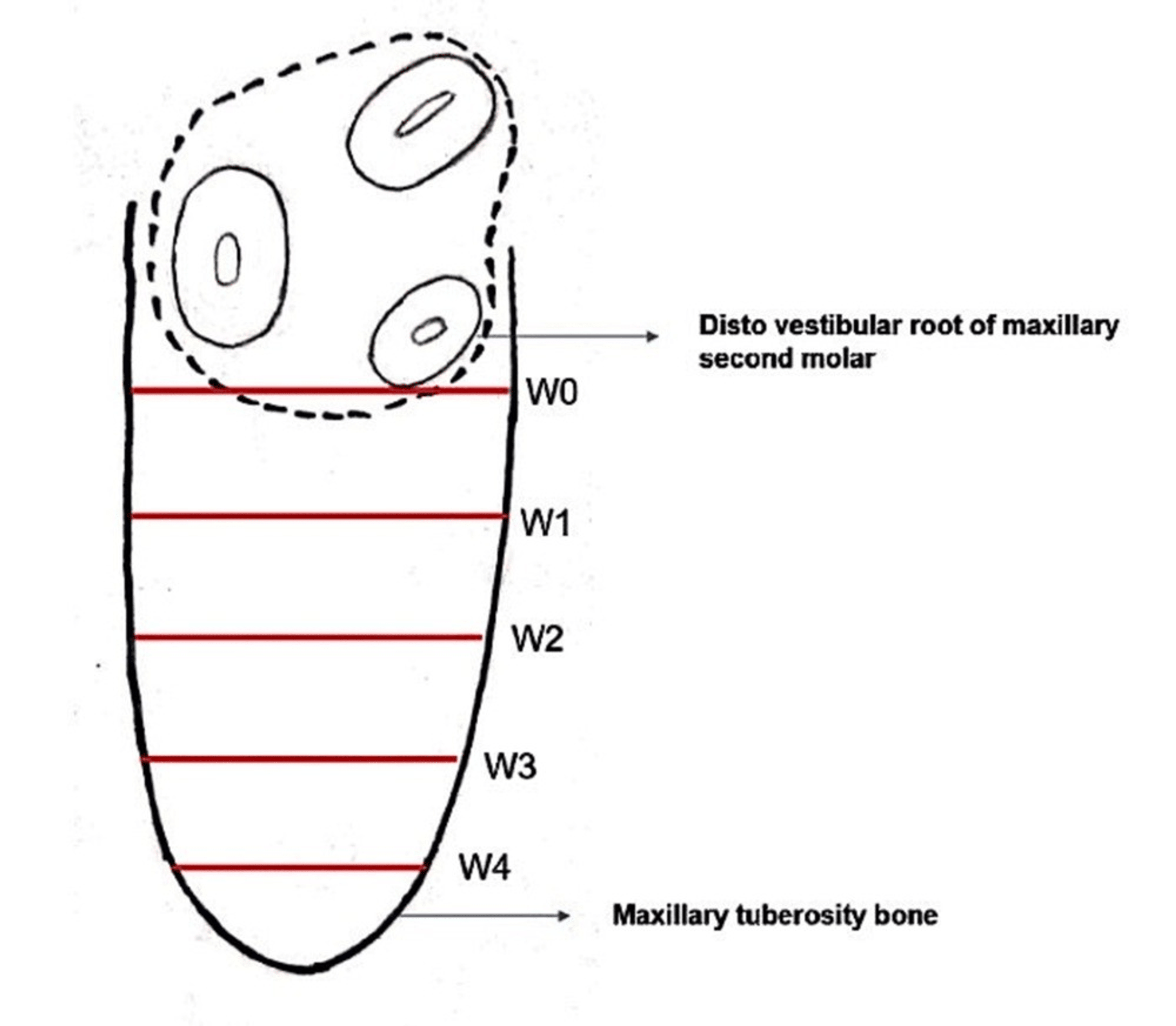 Cureus ThreeDimensional Assessment and Comparison of the Maxillary