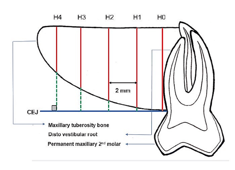 Cureus ThreeDimensional Assessment and Comparison of the Maxillary