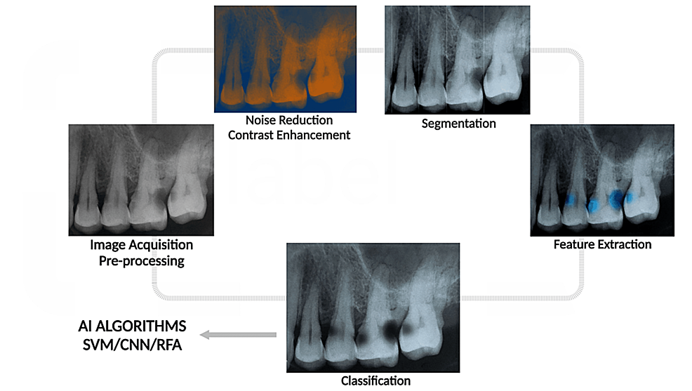 AI for efficiency, reliability and accuracy in practice - Dentistry