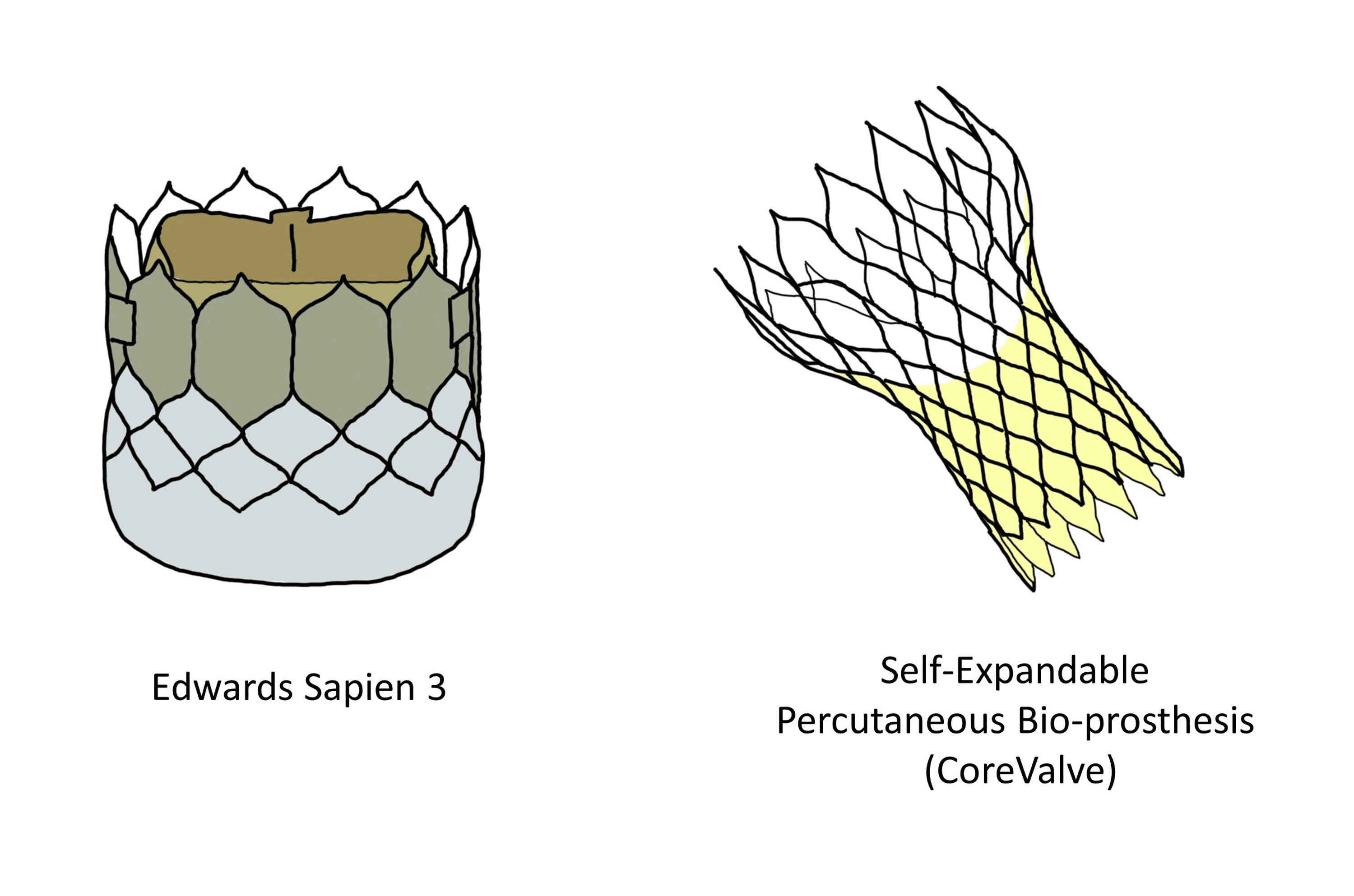 Scientific Evolution of Artificial Heart Valves A Narrative Review