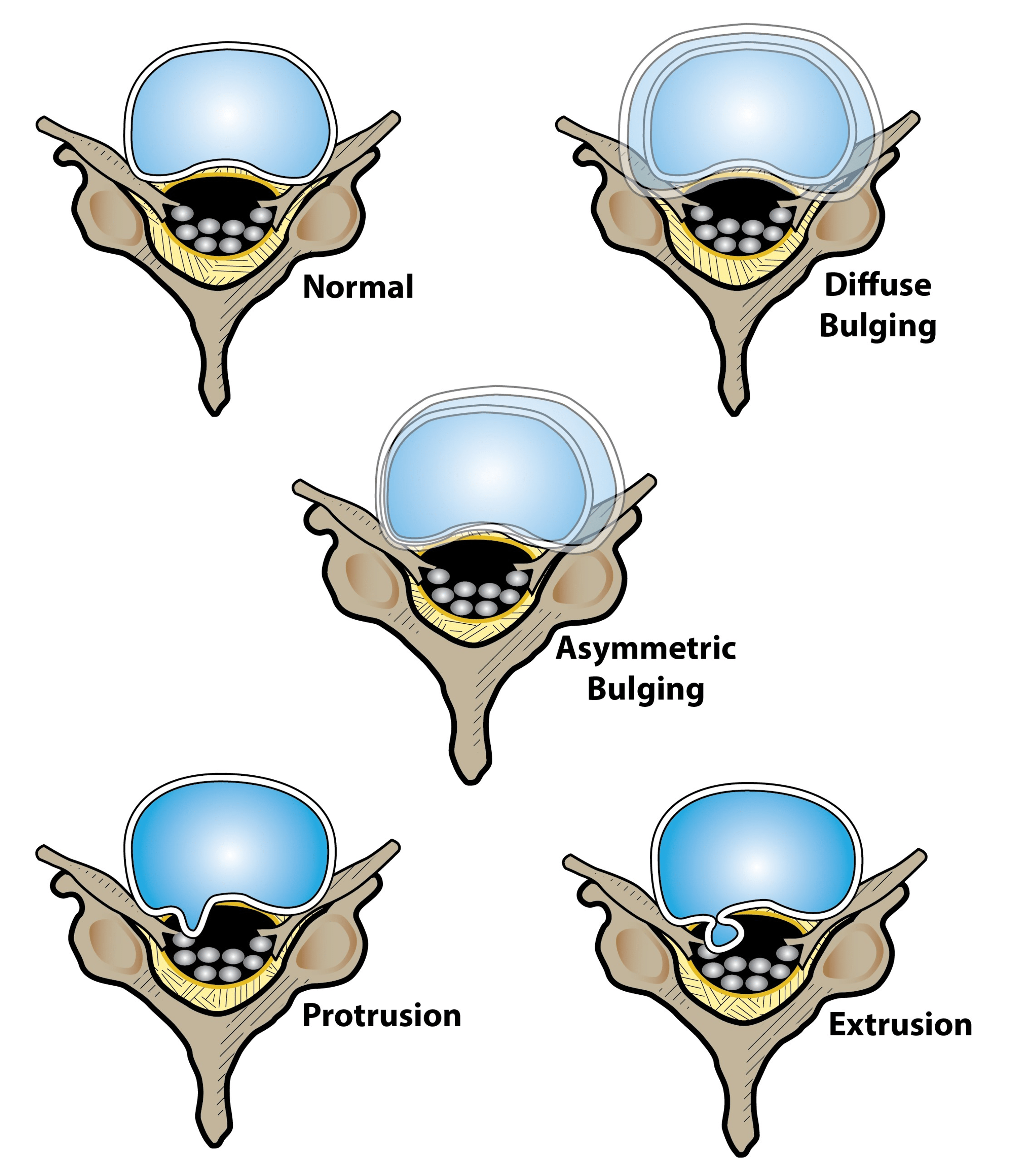 Cureus The Invasive Management of Pain Diagnosis and New Treatment