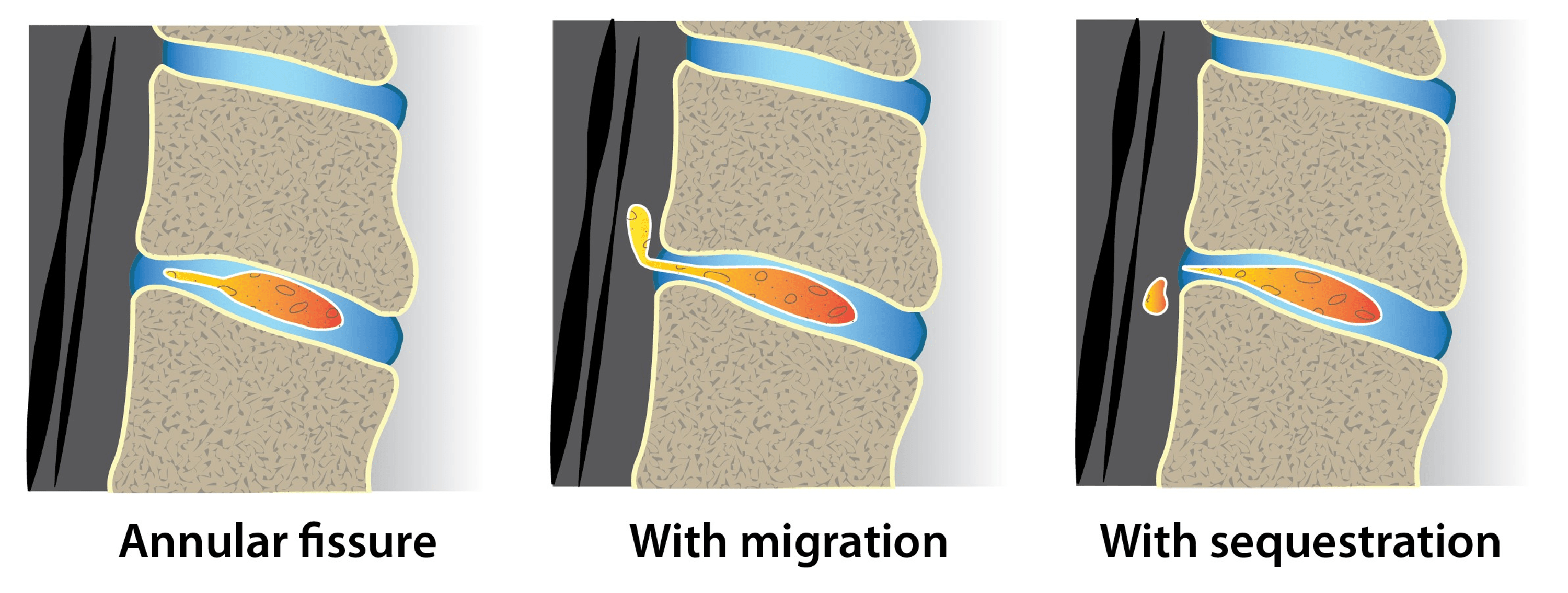 Cureus The Invasive Management of Pain Diagnosis and New Treatment