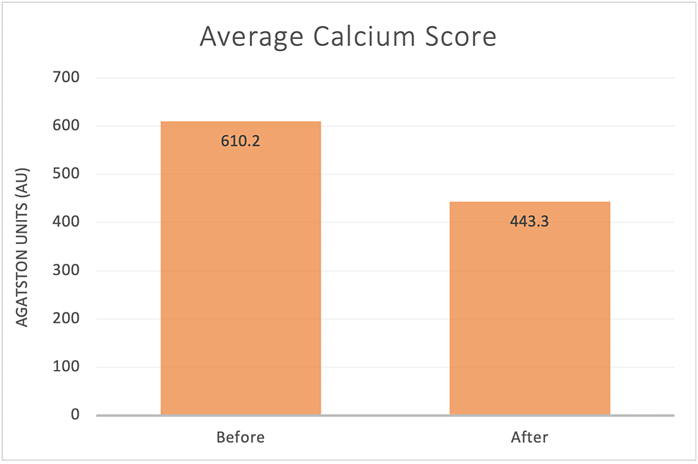Average-Calcium-Score-Before-and-After-Chelation-Therapy