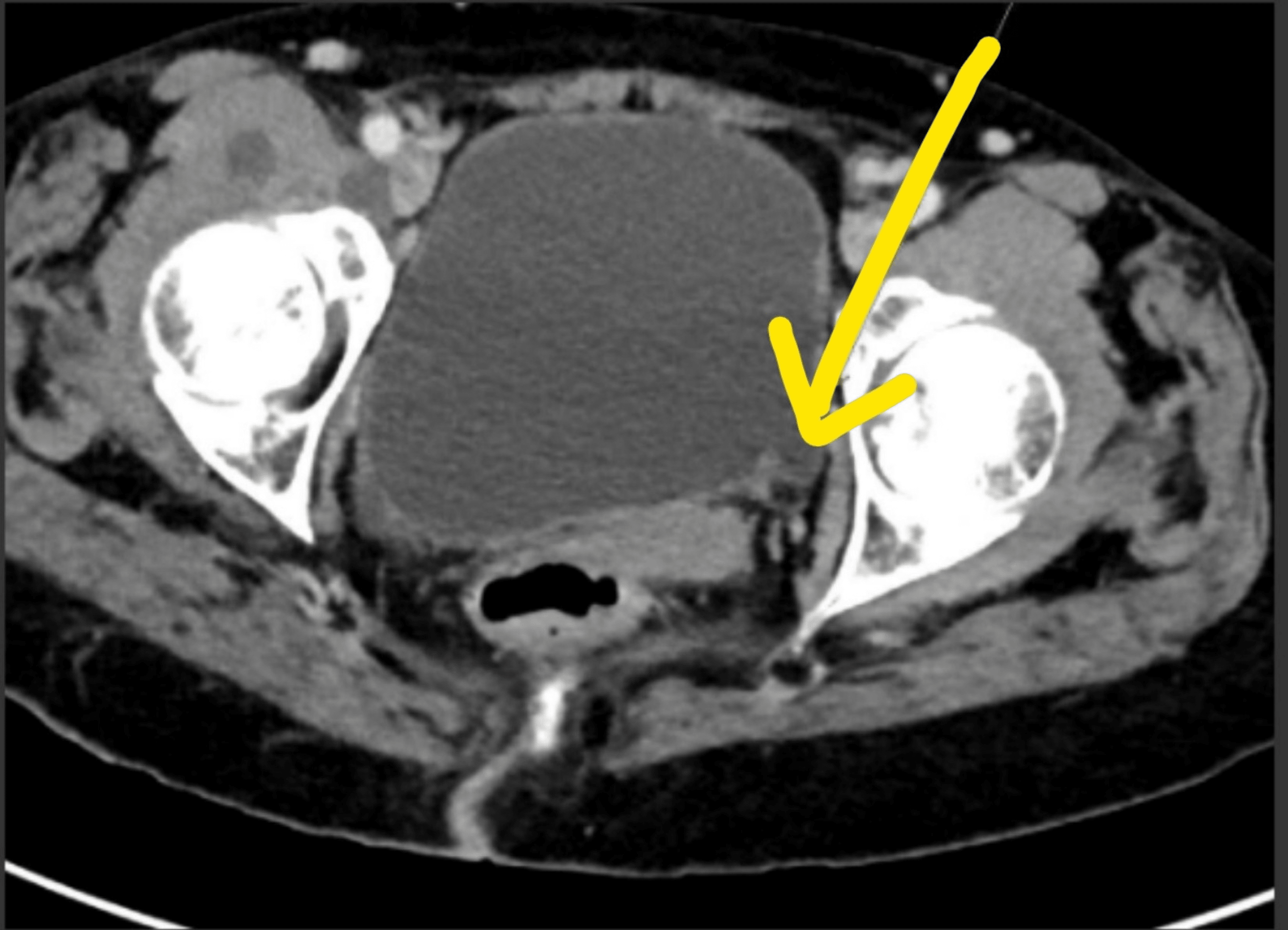 Cureus Look Beyond Syncope A Positive in the Management of
