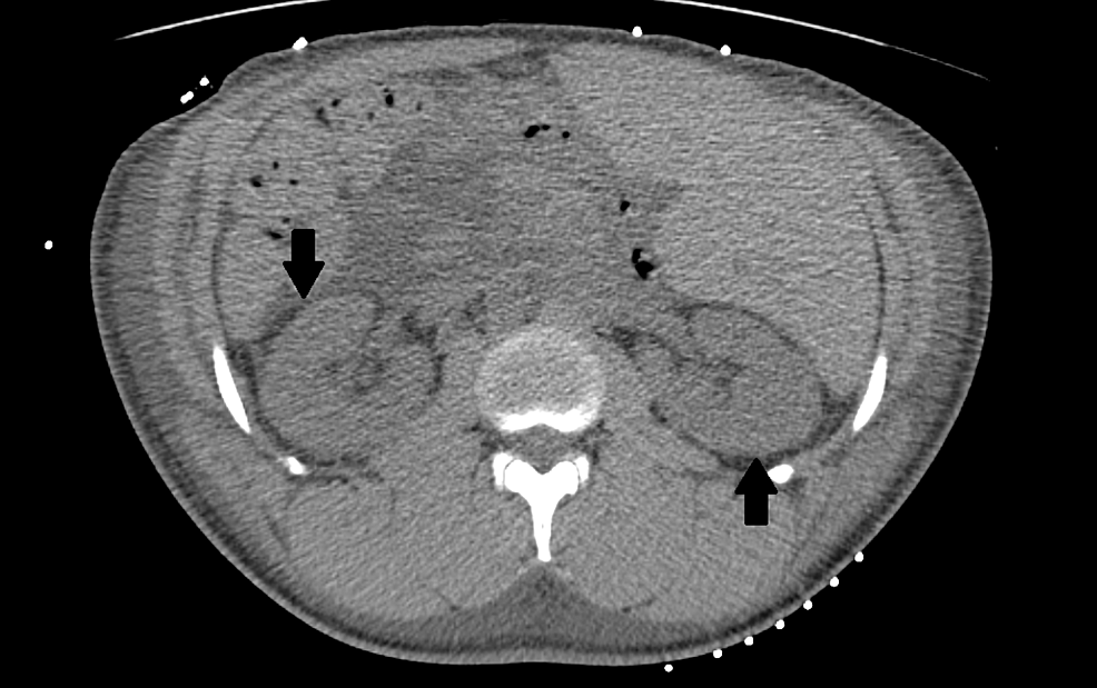 CT-scan-abdomen-and-pelvis