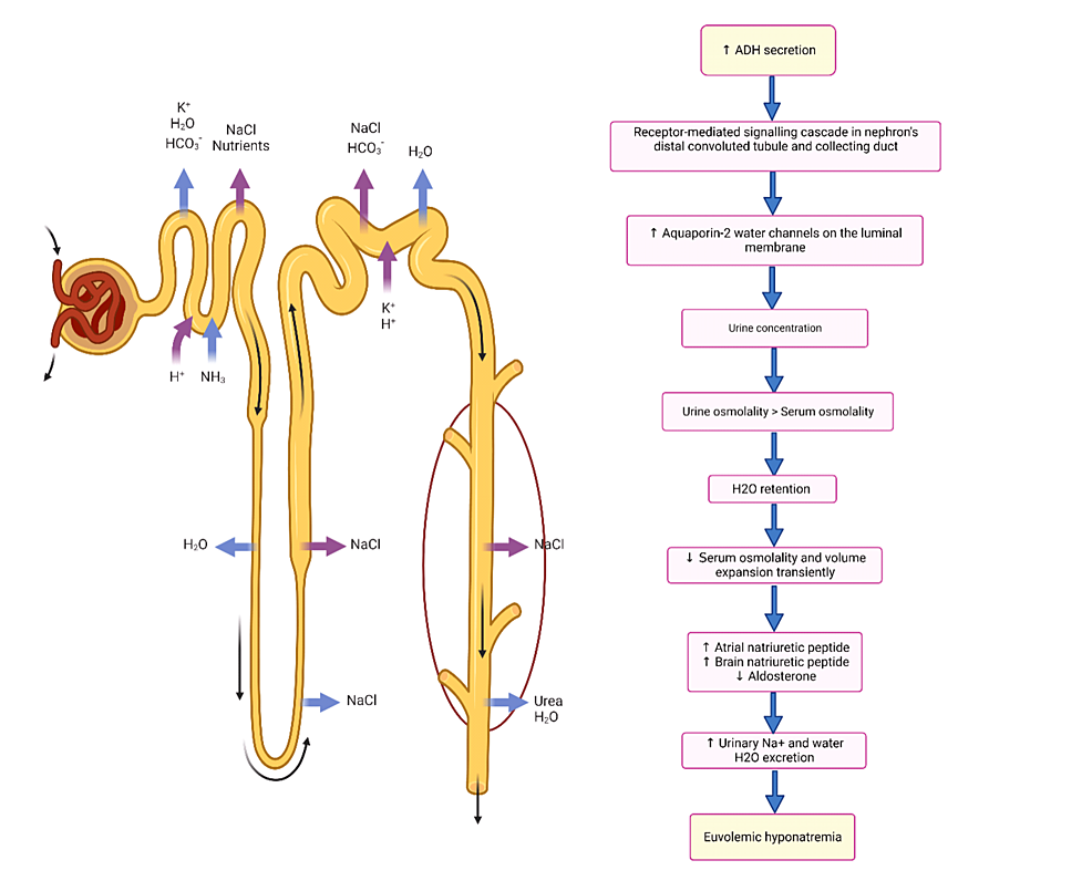 Cureus, A Conspectus of Euvolemic Hyponatremia, Its Various Etiologies,  and Treatment Modalities: A Comprehensive Review of the Literature