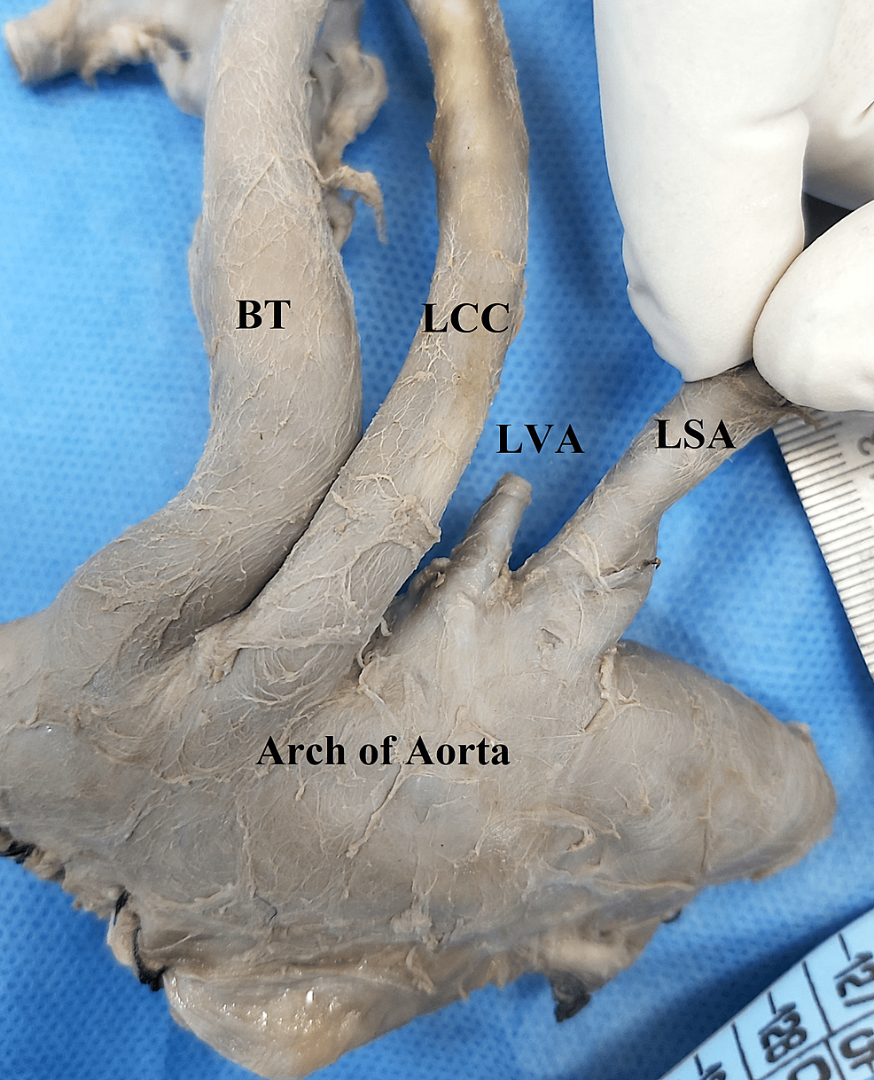 Anson and McVay Surgical Anatomy