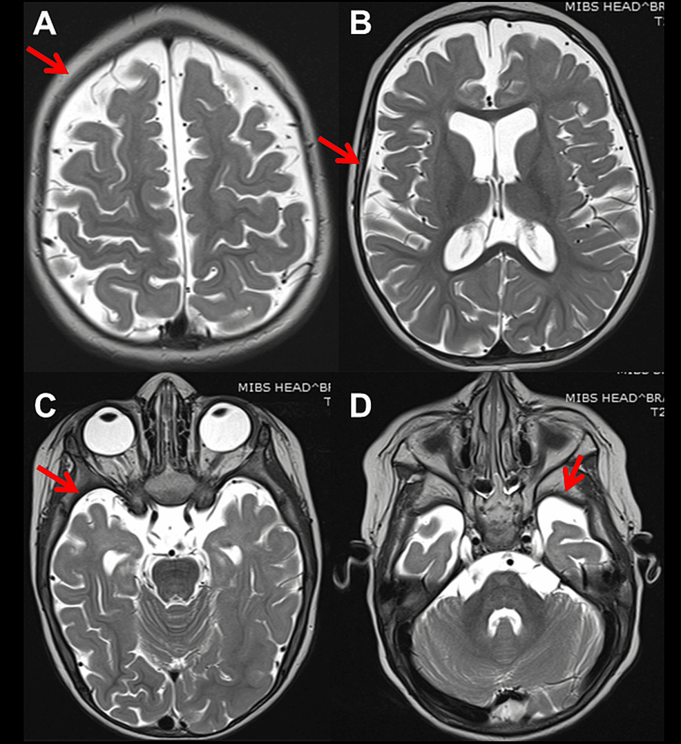 diazepam 10 mg for mri