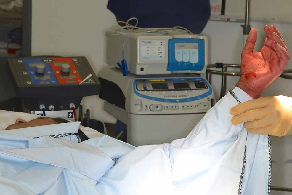 Elevation-of-the-arm