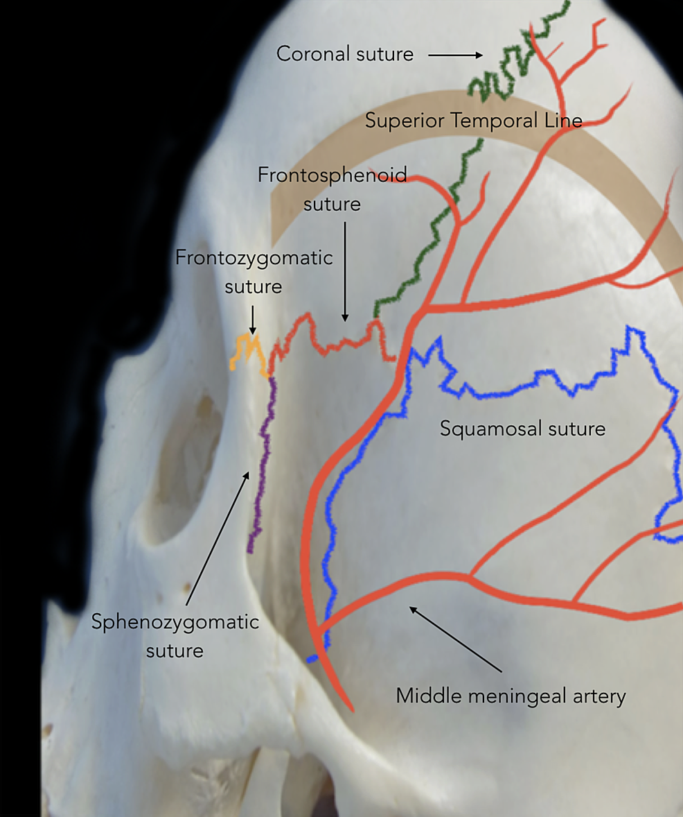 cureus-immersive-surgical-anatomy-of-the-pterional-approach