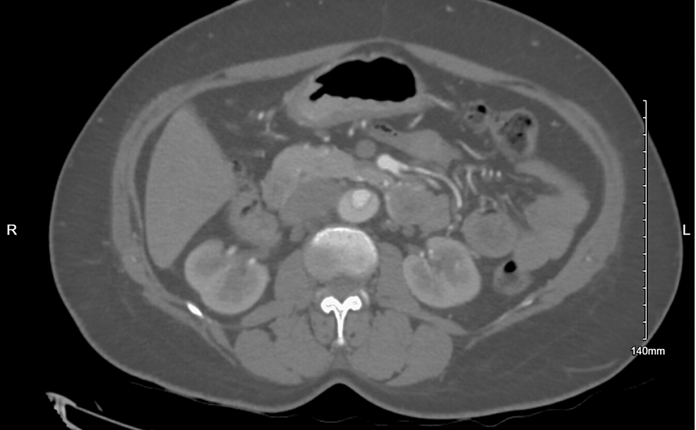 Cureus Point Of Care Ultrasound Unveils Life Threatening Conditions