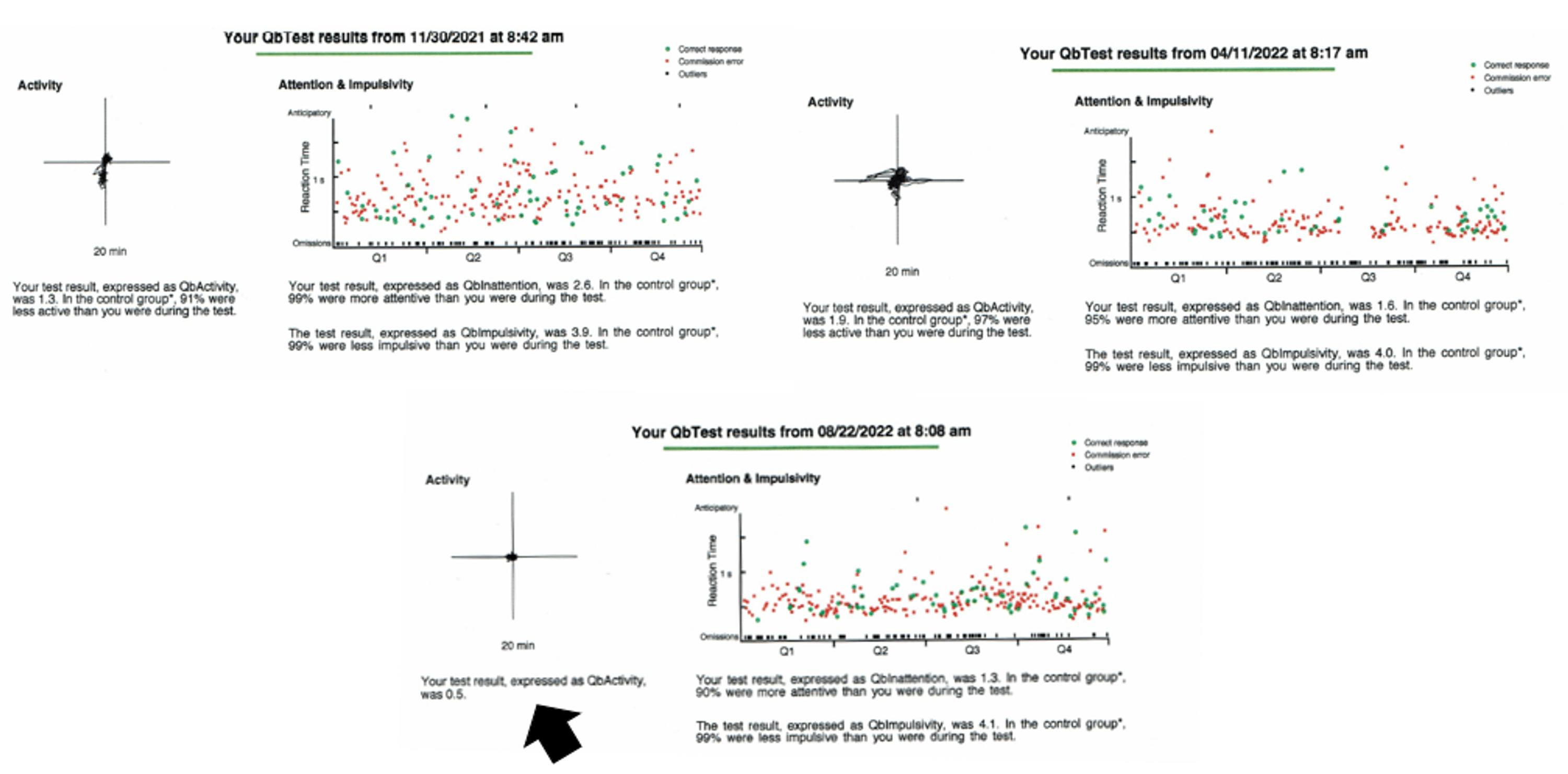 Cureus A Rare Case of HaoFountain Syndrome Mimicking Fragile X Syndrome