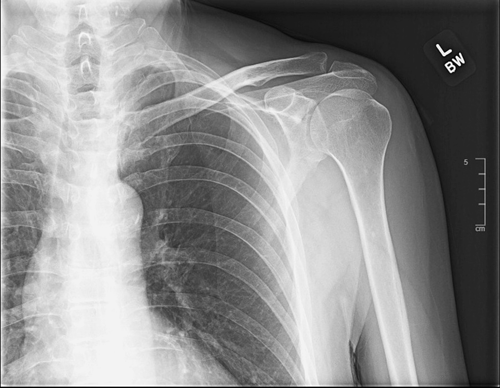 Streptococcal toxic shock syndrome in the intensive care unit, Annals of  Intensive Care