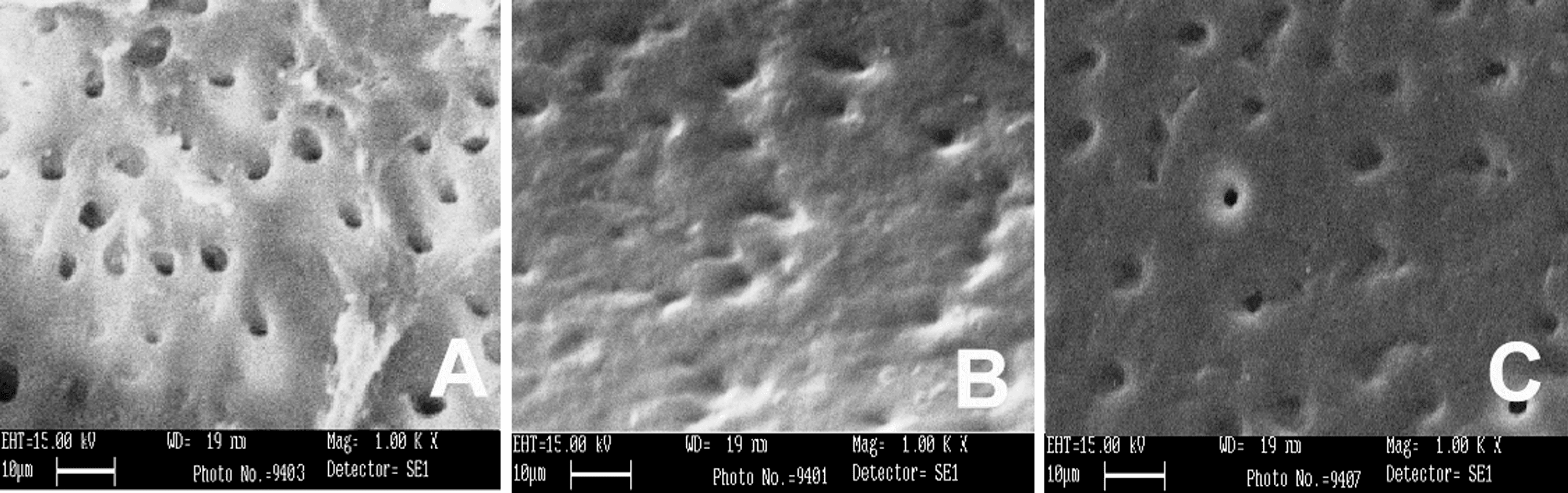 Cureus Efficacy of Different Root Canal Irrigating Solutions in