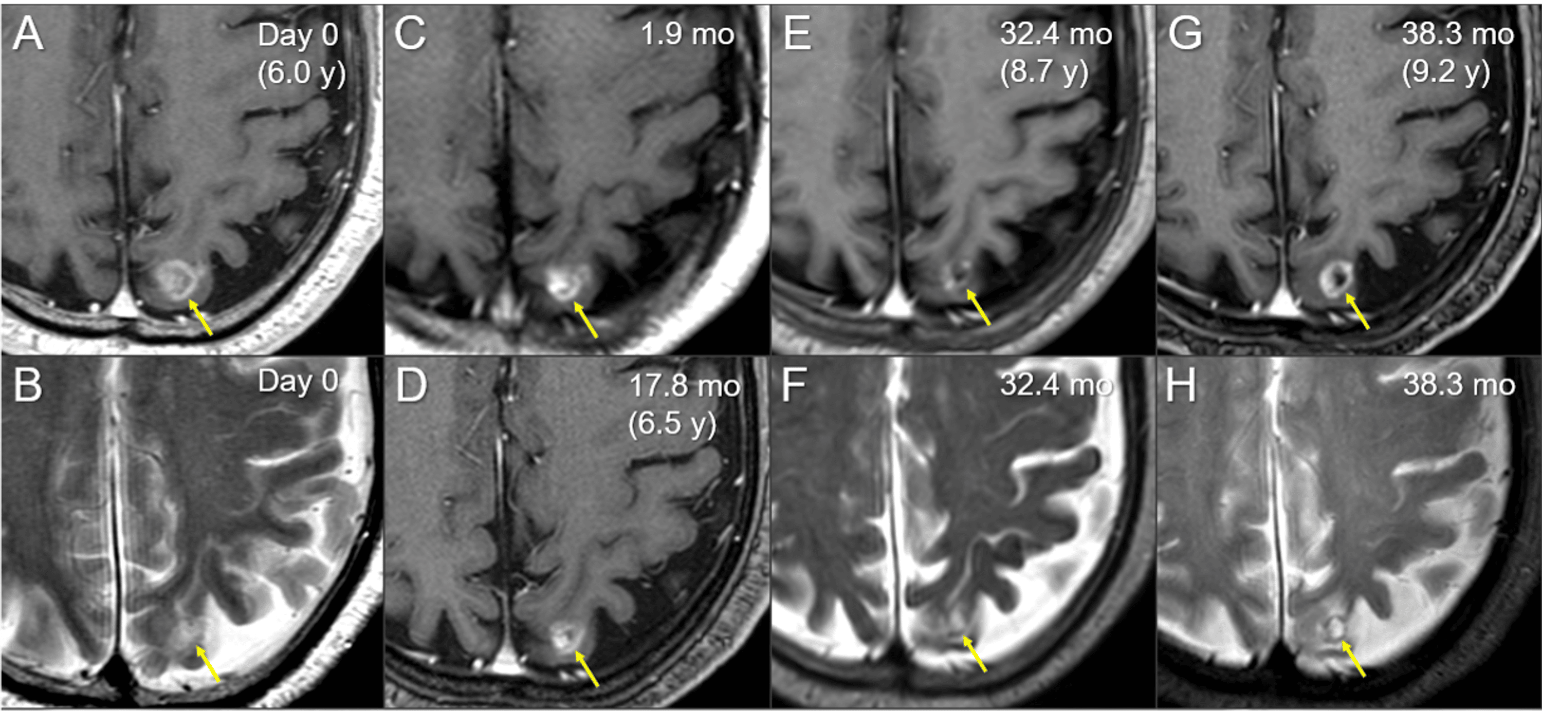 Cureus Immunity to Adverse Radiation Effects Following
