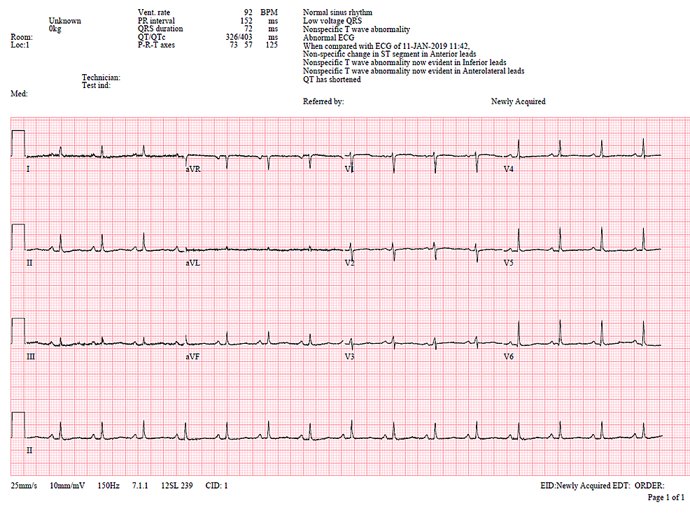 Cureus | A Rare Case of Purulent Pericardial TB