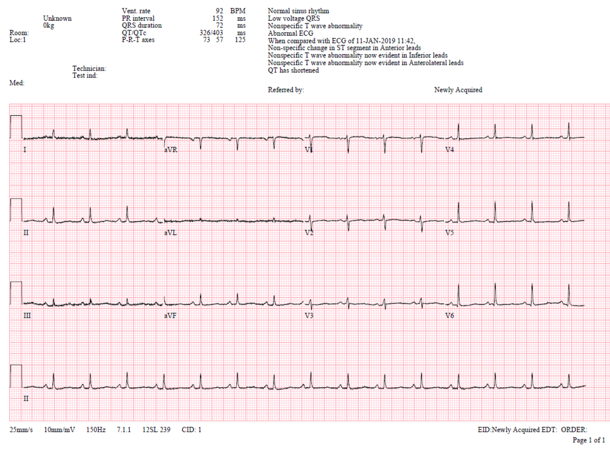 Cureus A Rare Case of Purulent Pericardial TB