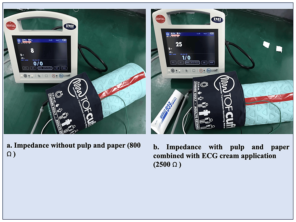 Electrocardiogram Cream Reduces SkinElectrode Impedance Upon