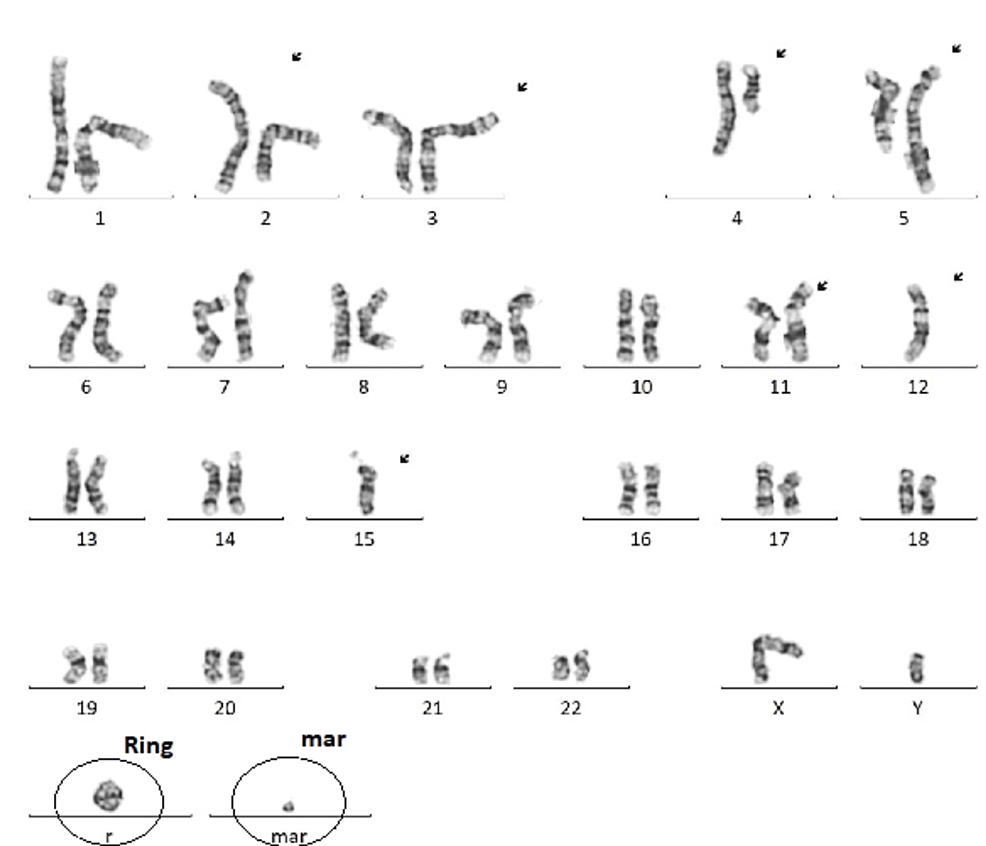 Giemsa-stained (A), NOR-bearing chromosome pair in the inset (B) and... |  Download Scientific Diagram
