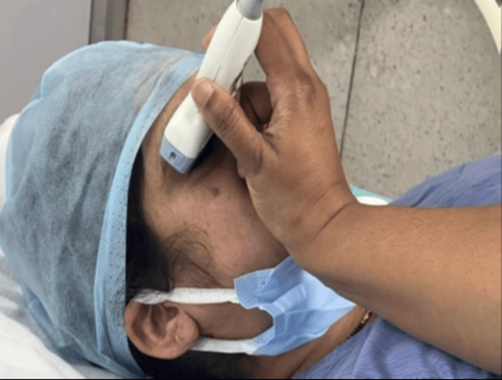 Effect of Tourniquet Deflation on Intracranial Pressure Measured by