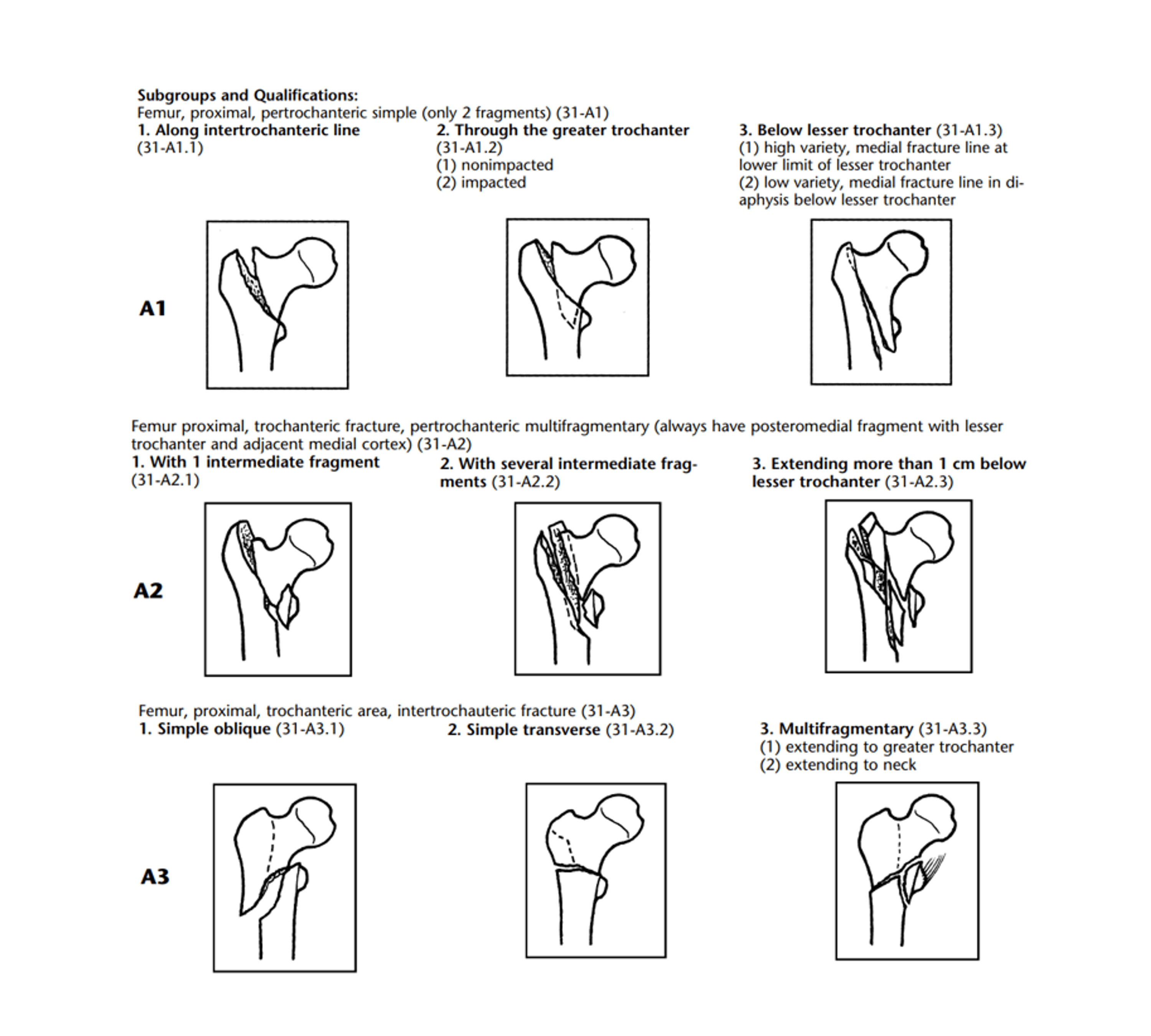 Cureus Management of Trochanteric Fractures Are We NICE Compliant?