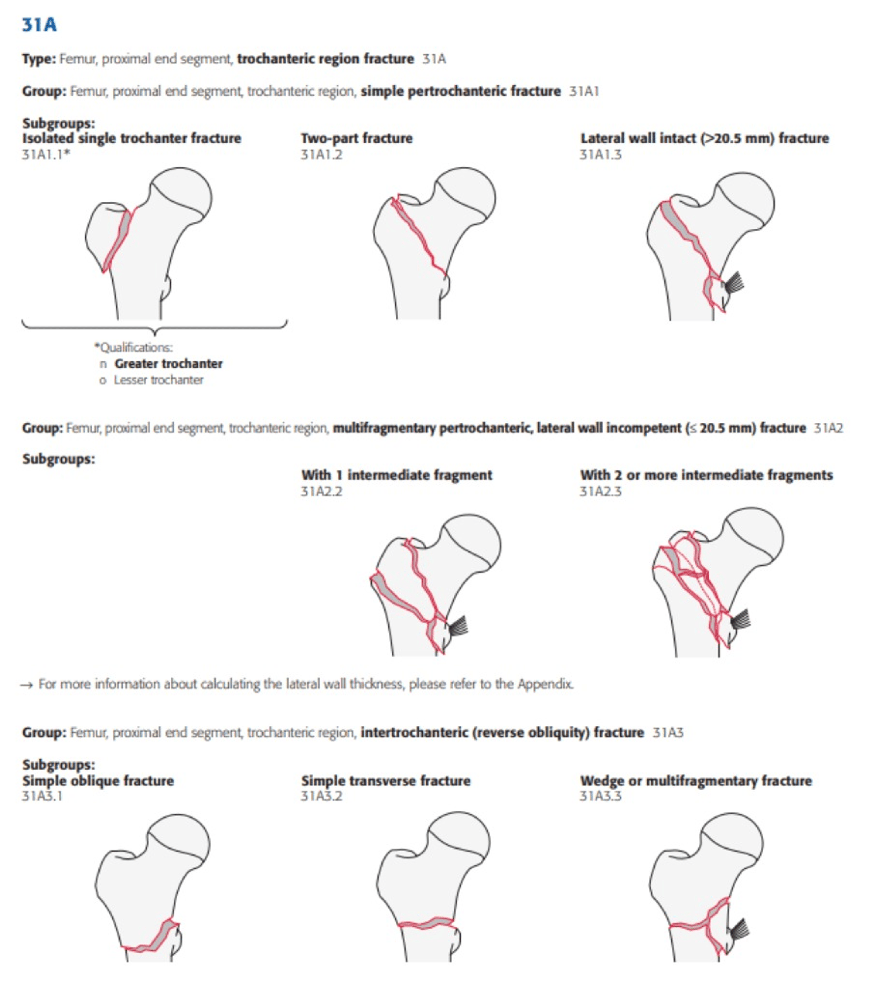 Management of Trochanteric Fractures Are We NICE Compliant? Cureus