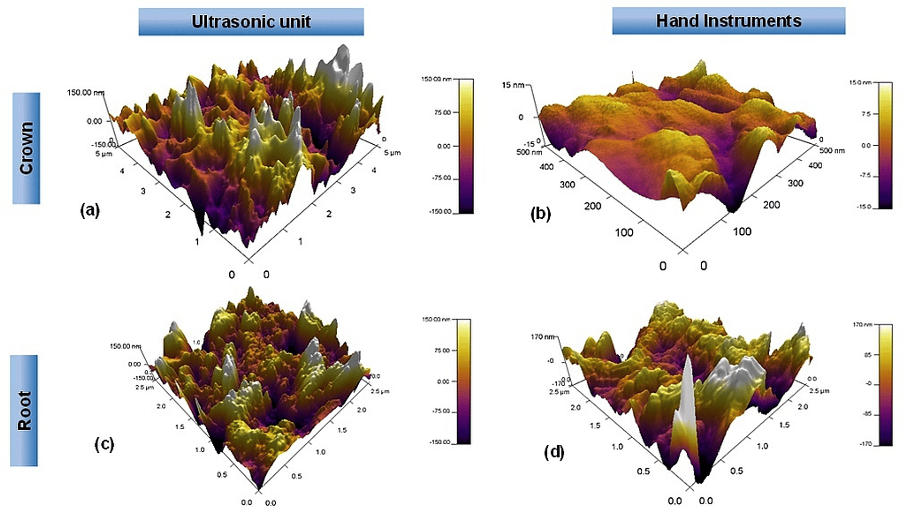 Cureus Effect of Hand and Ultrasonic ScalingRoot Planing Methods on