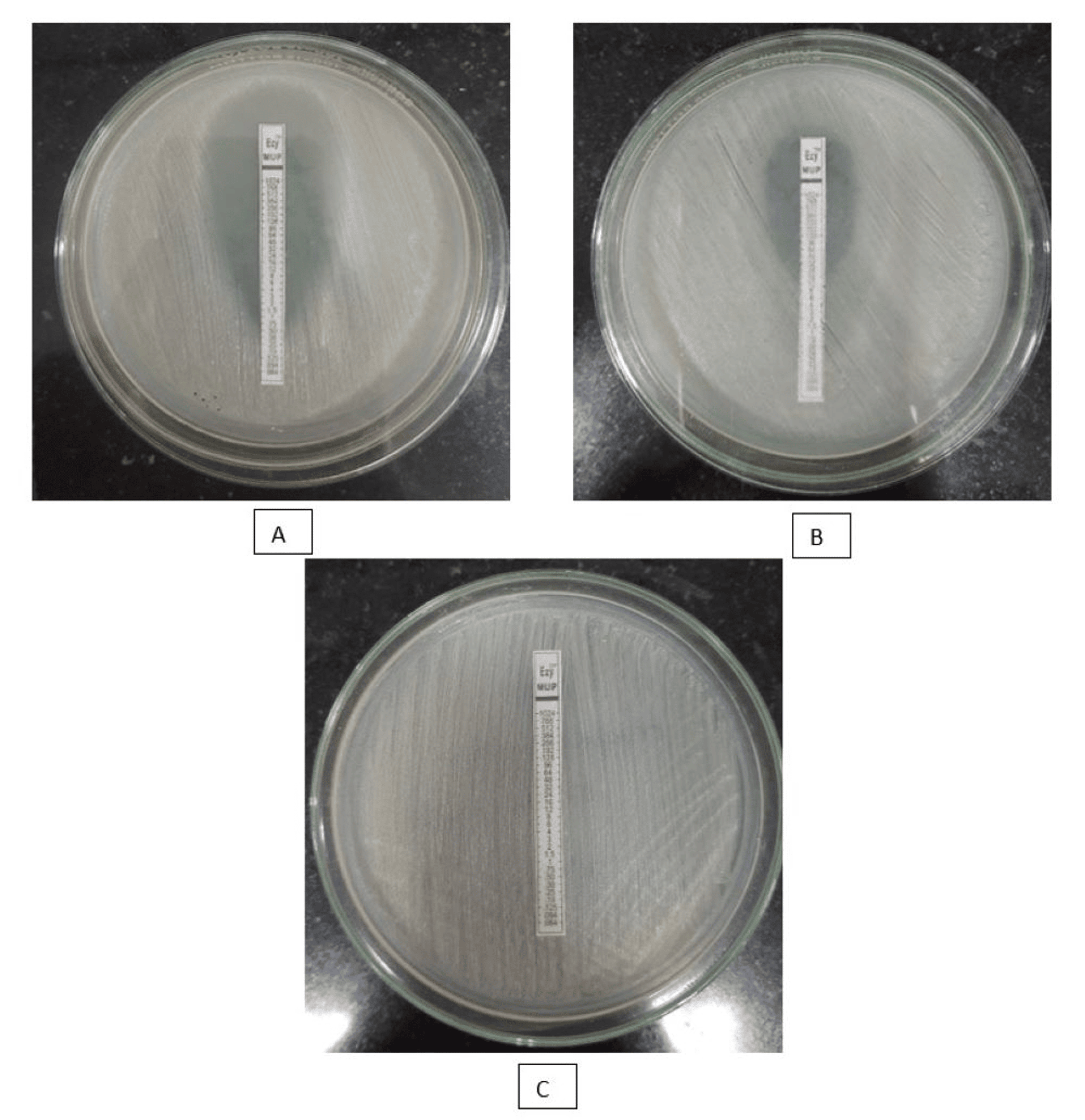 Prevalence Of Mupirocin And Methicillin-Resistant Staphylococcus Aureus ...