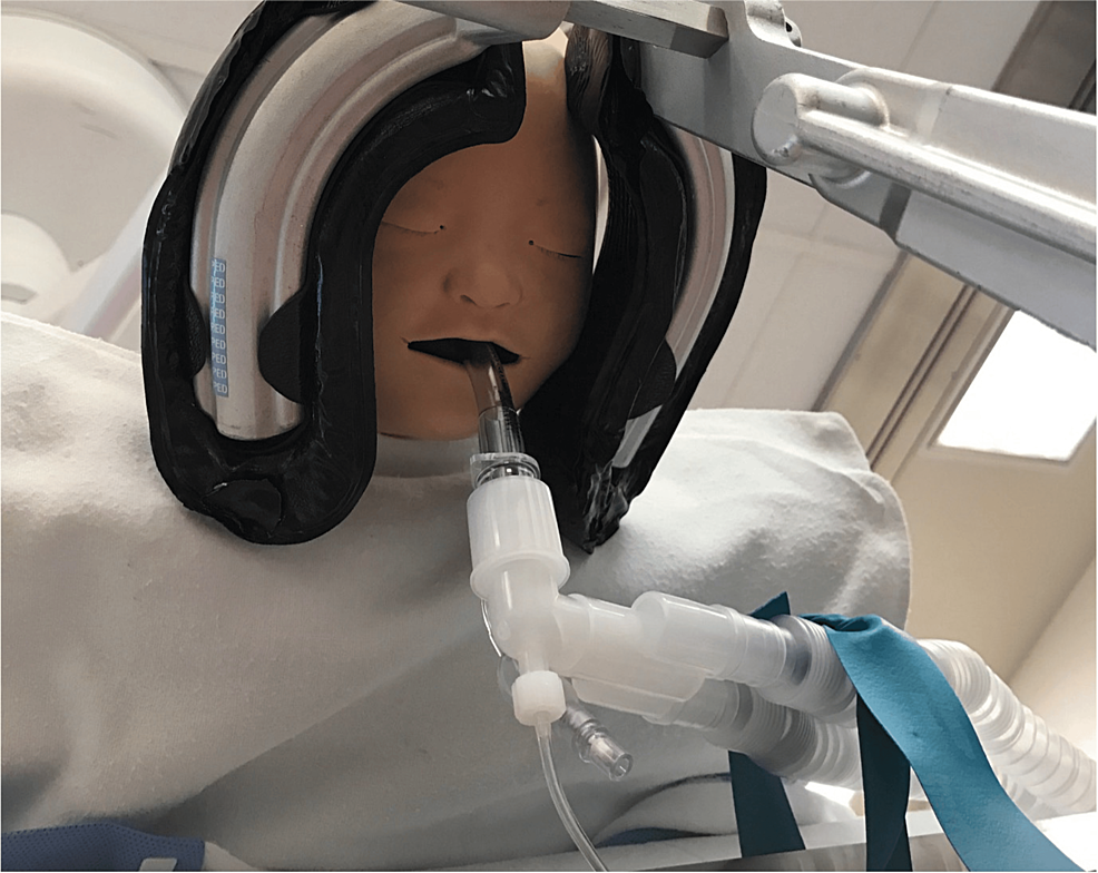 Successful Rescue Ventilation of an Infant With a Laryngeal Mask Airway After Accidental