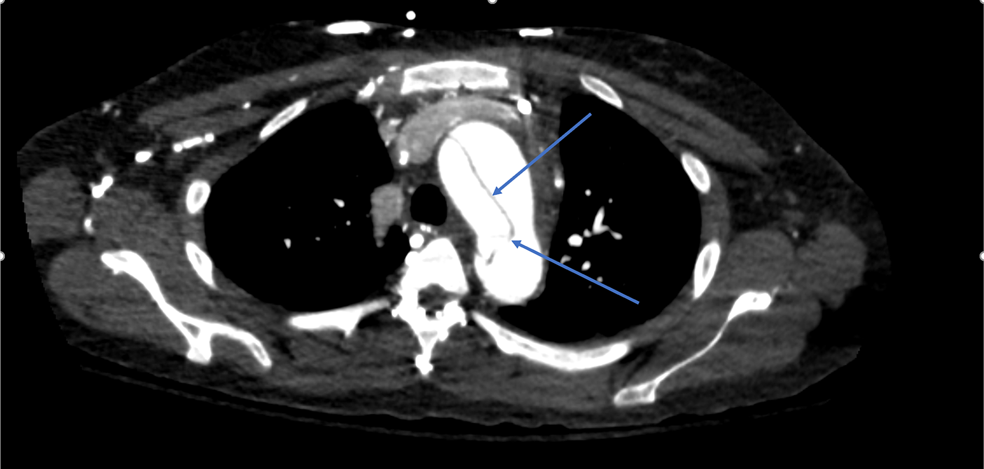 pdf health effects of low dose ionising radiation recent advances and their implications proceedings